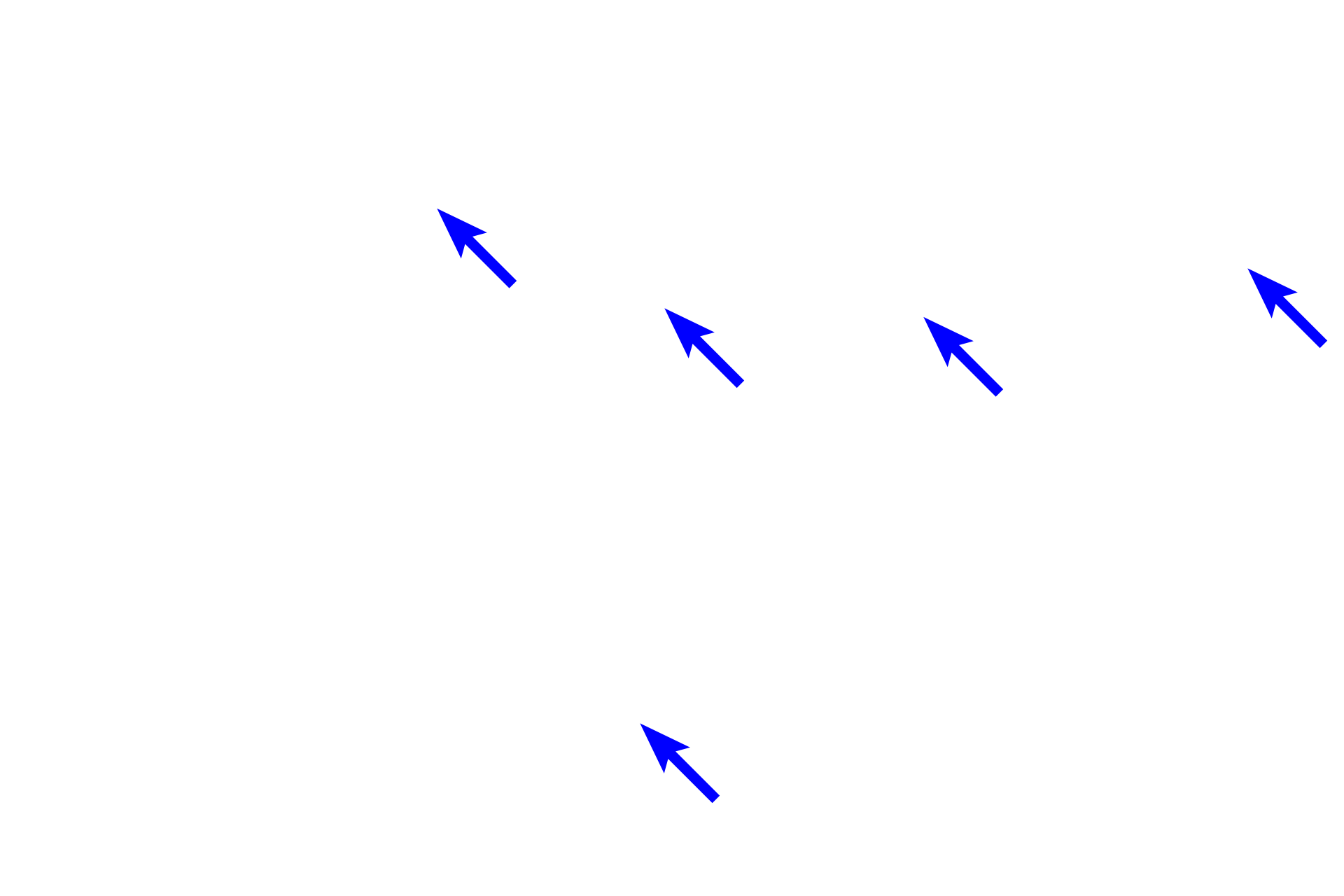 Unmyelinated axons <p>The pars nervosa is continuous with the infundibulum, the extension of the hypothalamus, and, thus, resembles nervous tissue. Unmyelinated axons from neurons in the supraoptic and paraventricular hypothalamic nuclei travel into the pars nervosa via the infundibulum and end as Herring bodies. Also present among the axons and terminals are pituicytes, highly branched cells that resemble astrocytes. 1000x</p>
