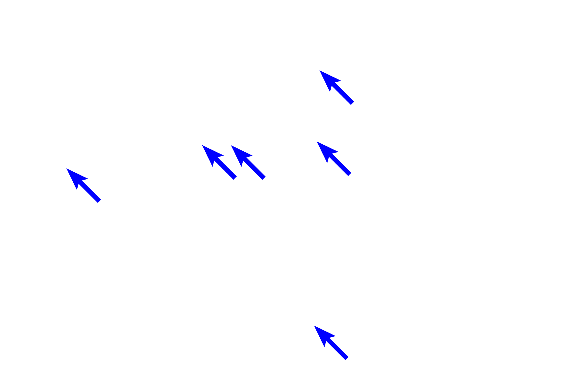Herring bodies <p>The pars nervosa is continuous with the infundibulum, the extension of the hypothalamus, and, thus, resembles nervous tissue. Unmyelinated axons from neurons in the supraoptic and paraventricular hypothalamic nuclei travel into the pars nervosa via the infundibulum and end as Herring bodies. Also present among the axons and terminals are pituicytes, highly branched cells that resemble astrocytes. 1000x</p>
