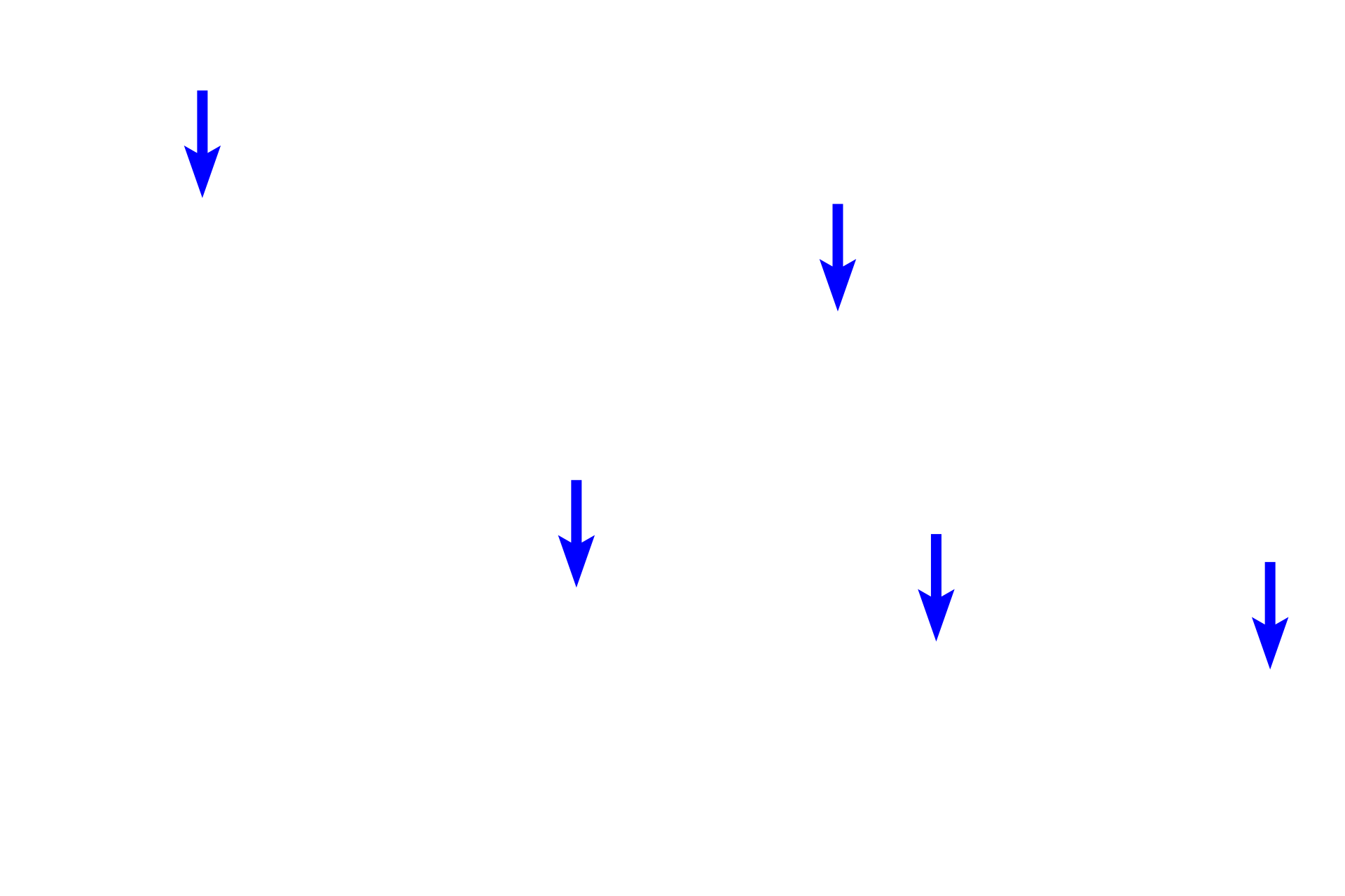 Pituicytes <p>The pars nervosa is continuous with the infundibulum, the extension of the hypothalamus, and, thus, resembles nervous tissue. Unmyelinated axons from neurons in the supraoptic and paraventricular hypothalamic nuclei travel into the pars nervosa via the infundibulum and end as Herring bodies. Also present among the axons and terminals are pituicytes, highly branched cells that resemble astrocytes. 1000x</p>
