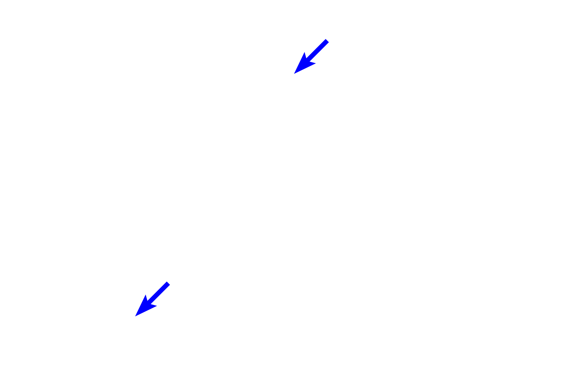 Capillaries <p>The pars nervosa is continuous with the infundibulum, the extension of the hypothalamus, and, thus, resembles nervous tissue. Unmyelinated axons from neurons in the supraoptic and paraventricular hypothalamic nuclei travel into the pars nervosa via the infundibulum and end as Herring bodies. Also present among the axons and terminals are pituicytes, highly branched cells that resemble astrocytes. 1000x</p>
