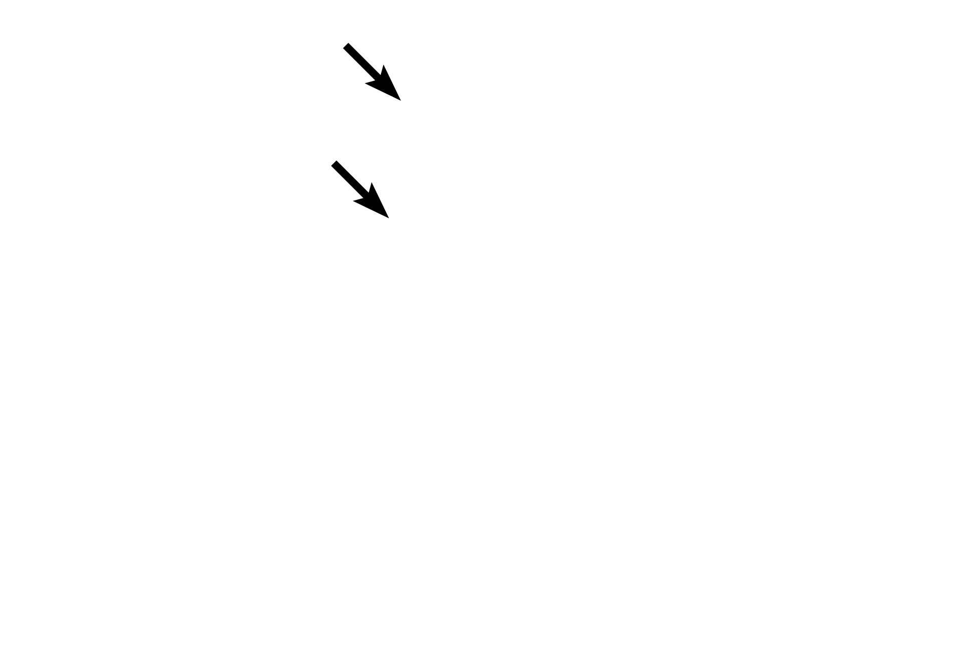  - Infundibulum <p>This low magnification of a monkey pituitary is cut midsagittally and stained with hematoxylin and eosin.  Note the distinct boundaries between the neurohypophyseal and adenohypophyseal tissues, indicating the different embryological origins of these subdivisions.  5x</p>
