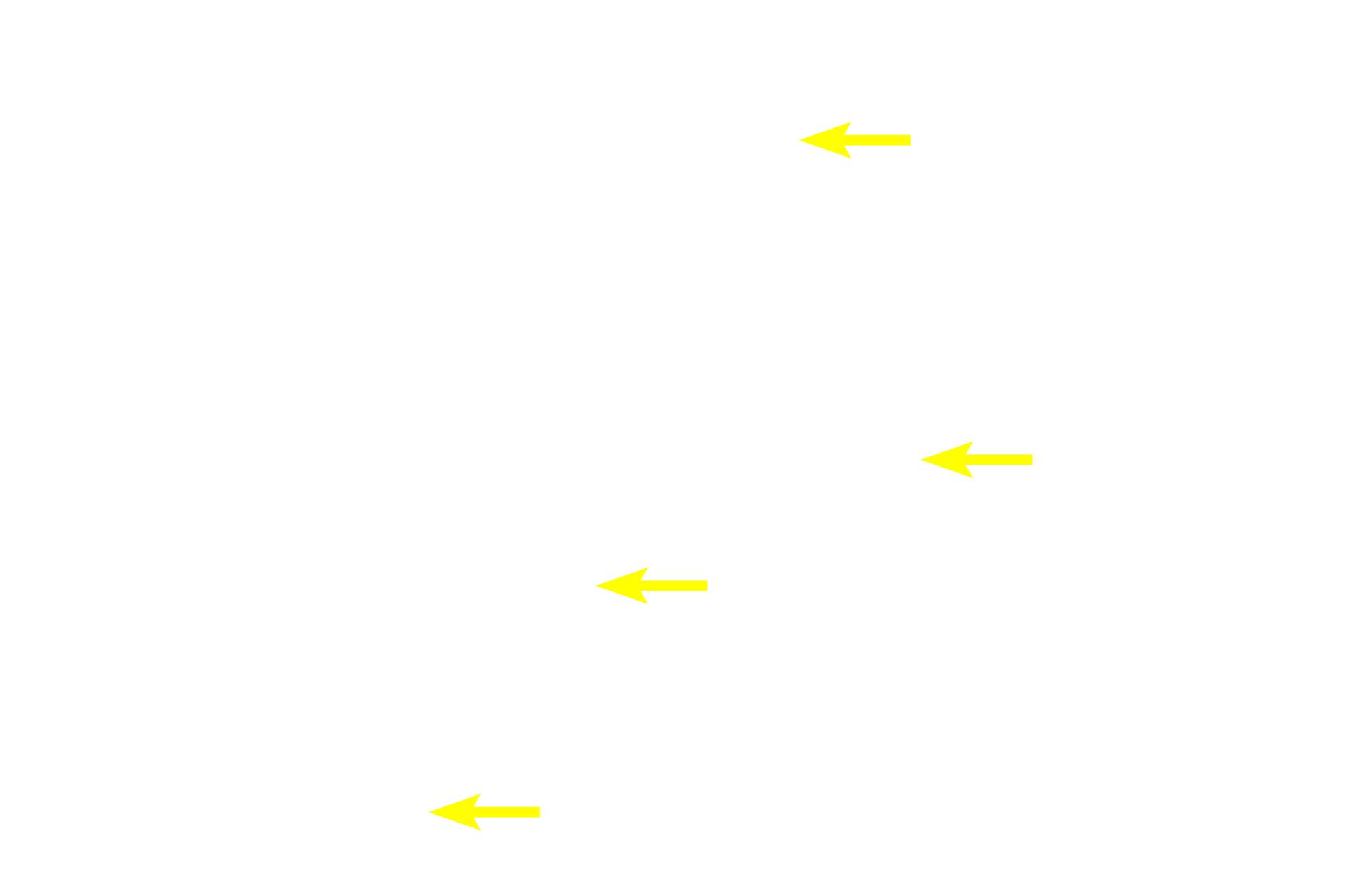Acidophils <p>Hematoxylin and eosin staining of the pars distalis reveals two general types of secretory cells, basophils and acidophils.  Basophils contain purple-staining granules; acidophils contain pink-staining, eosinophilic granules.  Cells without obvious granules are called chromophobes and may be either degranulated chromophils or reserve cells.  All cells are arranged in plates or cords with numerous intervening fenestrated capillaries.  400x</p>
