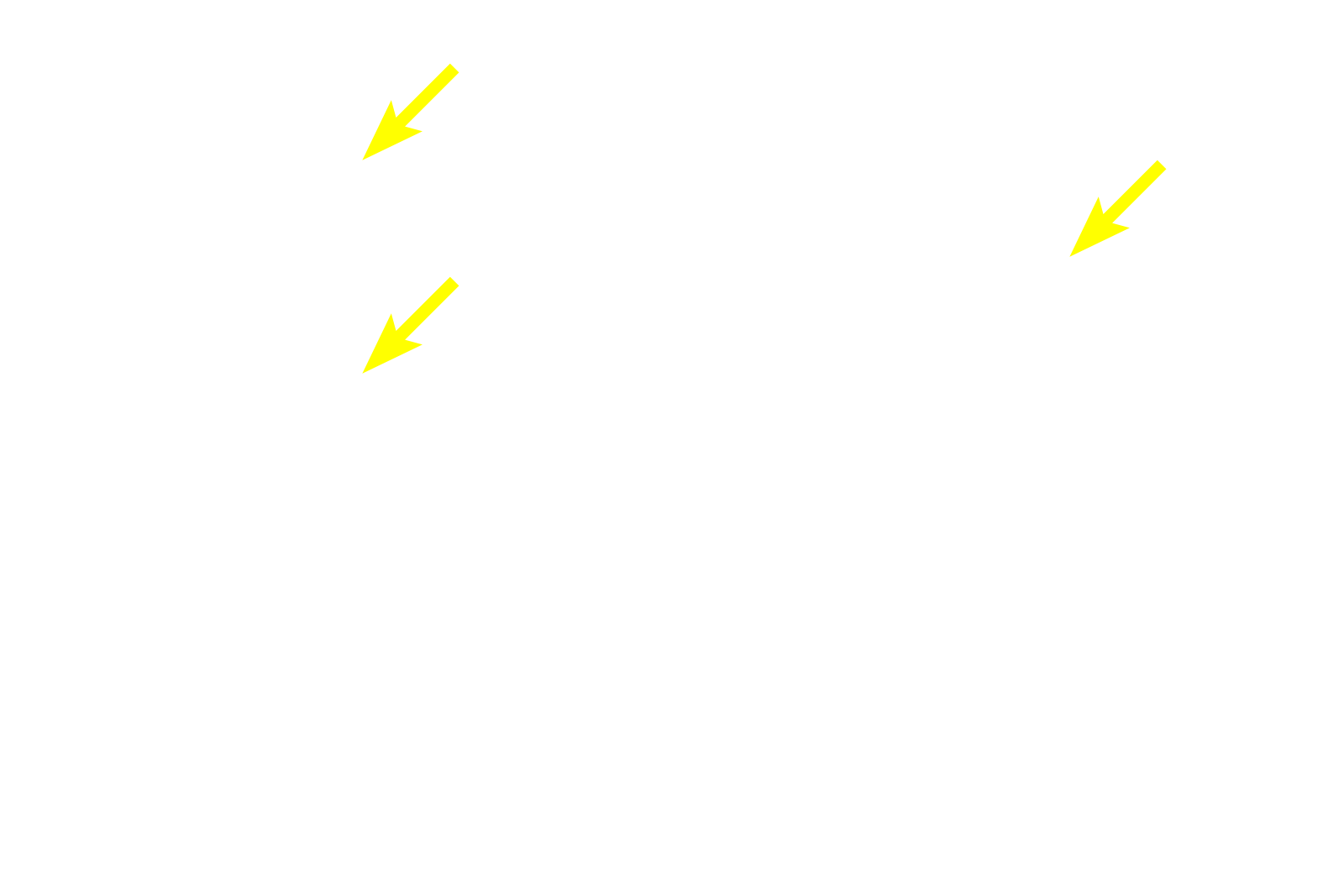 Basophils <p>Basophils and acidophils are identified by the staining affinities of their secretory granules for either hematoxylin (basophils) or eosin (acidophils).  Acidophils, the major cell type in this image, consist of growth hormone-secreting somatotropes and prolactin-secreting mammotropes.  These two cell types cannot be distinguished by routine hematoxylin and eosin staining.  1000x</p>
