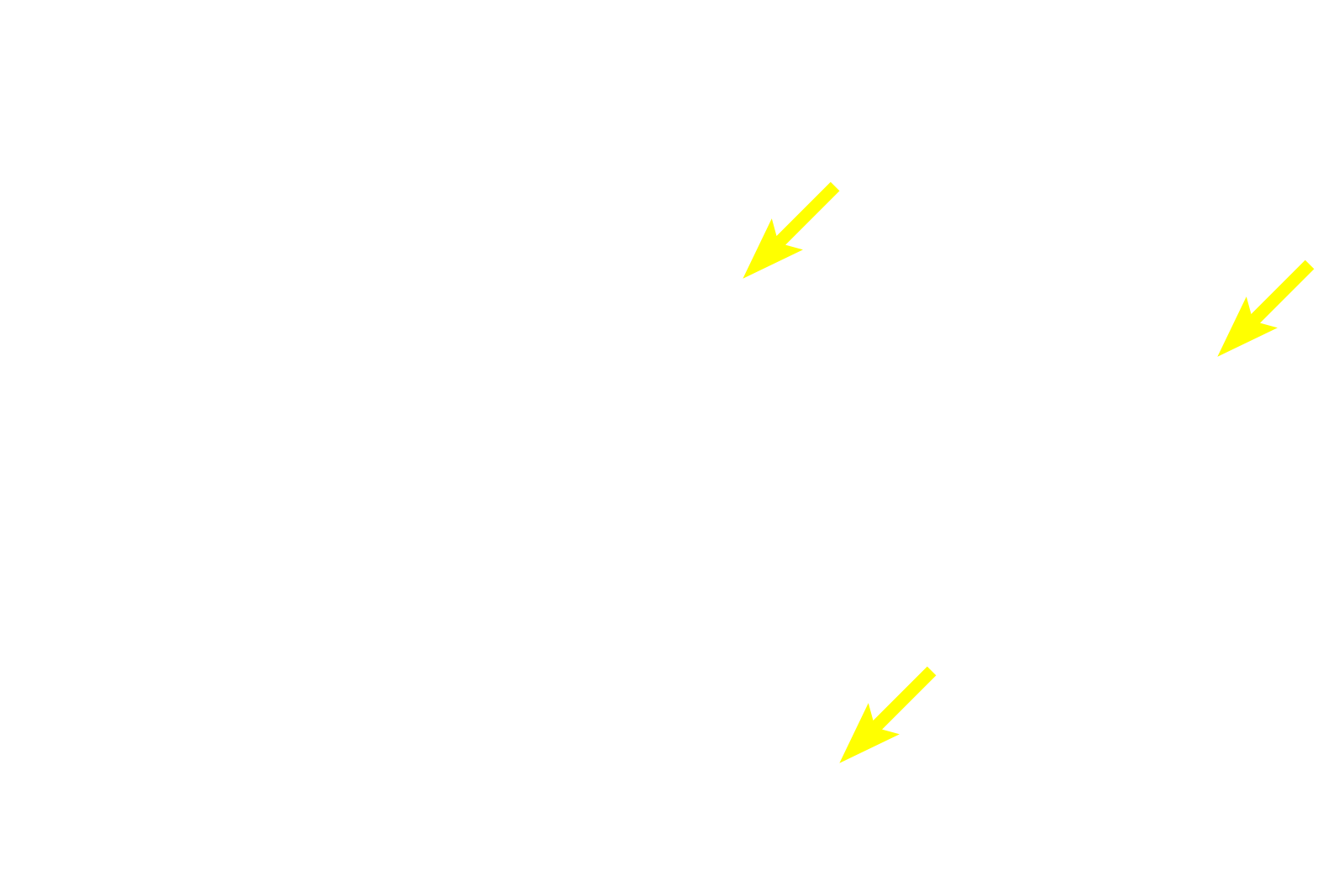 Acidophils <p>Basophils and acidophils are identified by the staining affinities of their secretory granules for either hematoxylin (basophils) or eosin (acidophils).  Acidophils, the major cell type in this image, consist of growth hormone-secreting somatotropes and prolactin-secreting mammotropes.  These two cell types cannot be distinguished by routine hematoxylin and eosin staining.  1000x</p>
