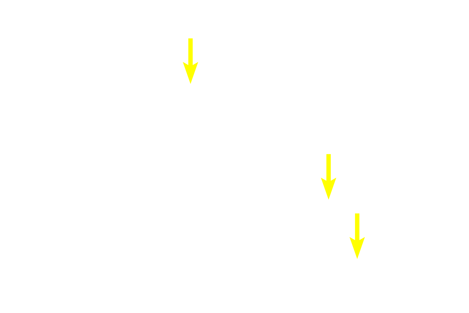 Chromophobes <p>Basophils and acidophils are identified by the staining affinities of their secretory granules for either hematoxylin (basophils) or eosin (acidophils).  Acidophils, the major cell type in this image, consist of growth hormone-secreting somatotropes and prolactin-secreting mammotropes.  These two cell types cannot be distinguished by routine hematoxylin and eosin staining.  1000x</p>
