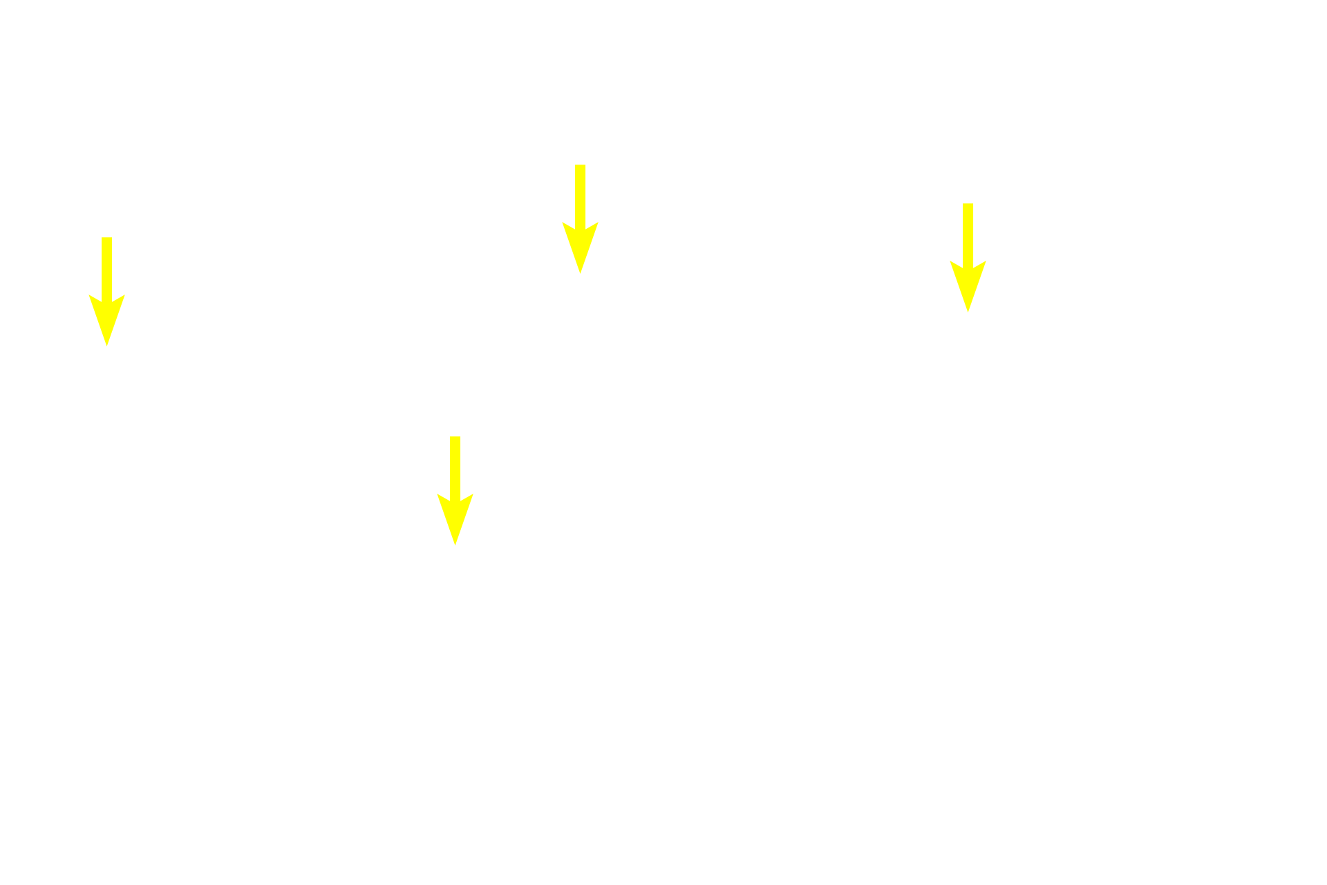 Basophils <p>Basophils, the major cell type in this image, consist of gonadotropes (secreting follicle stimulating hormone, FSH, and luteinizing hormone, LH), thyrotrophs (secreting thyroid stimulating hormone, TSH), and adrenocorticotropes (secreting adrenocorticotropic hormone, ACTH). These three cell types, however, cannot be distinguished by routine hematoxylin and eosin staining.  1000x</p>
