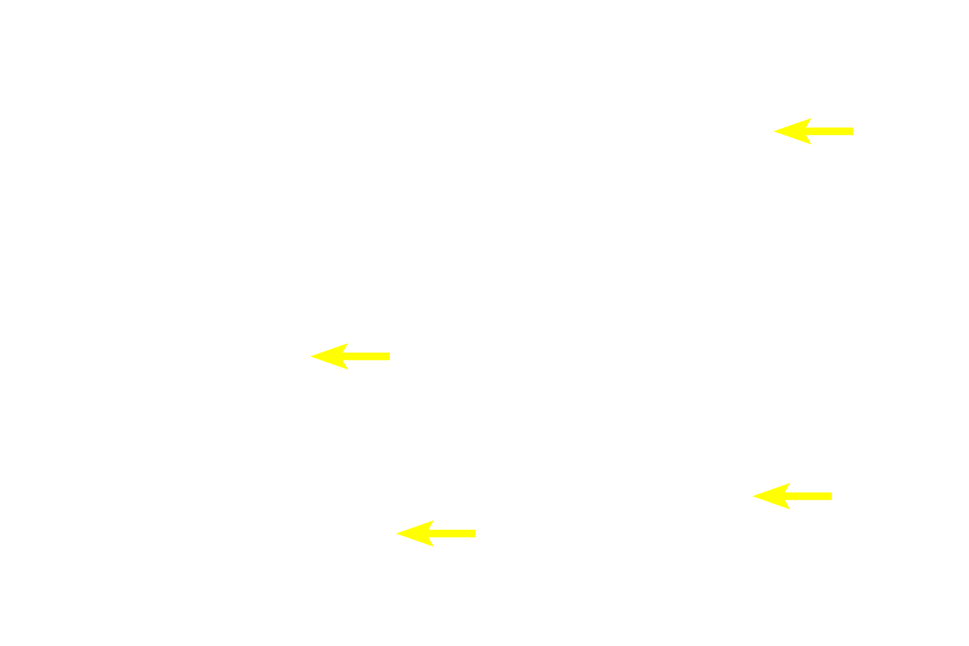 Acidophils <p>Basophils, the major cell type in this image, consist of gonadotropes (secreting follicle stimulating hormone, FSH, and luteinizing hormone, LH), thyrotrophs (secreting thyroid stimulating hormone, TSH), and adrenocorticotropes (secreting adrenocorticotropic hormone, ACTH). These three cell types, however, cannot be distinguished by routine hematoxylin and eosin staining.  1000x</p>

