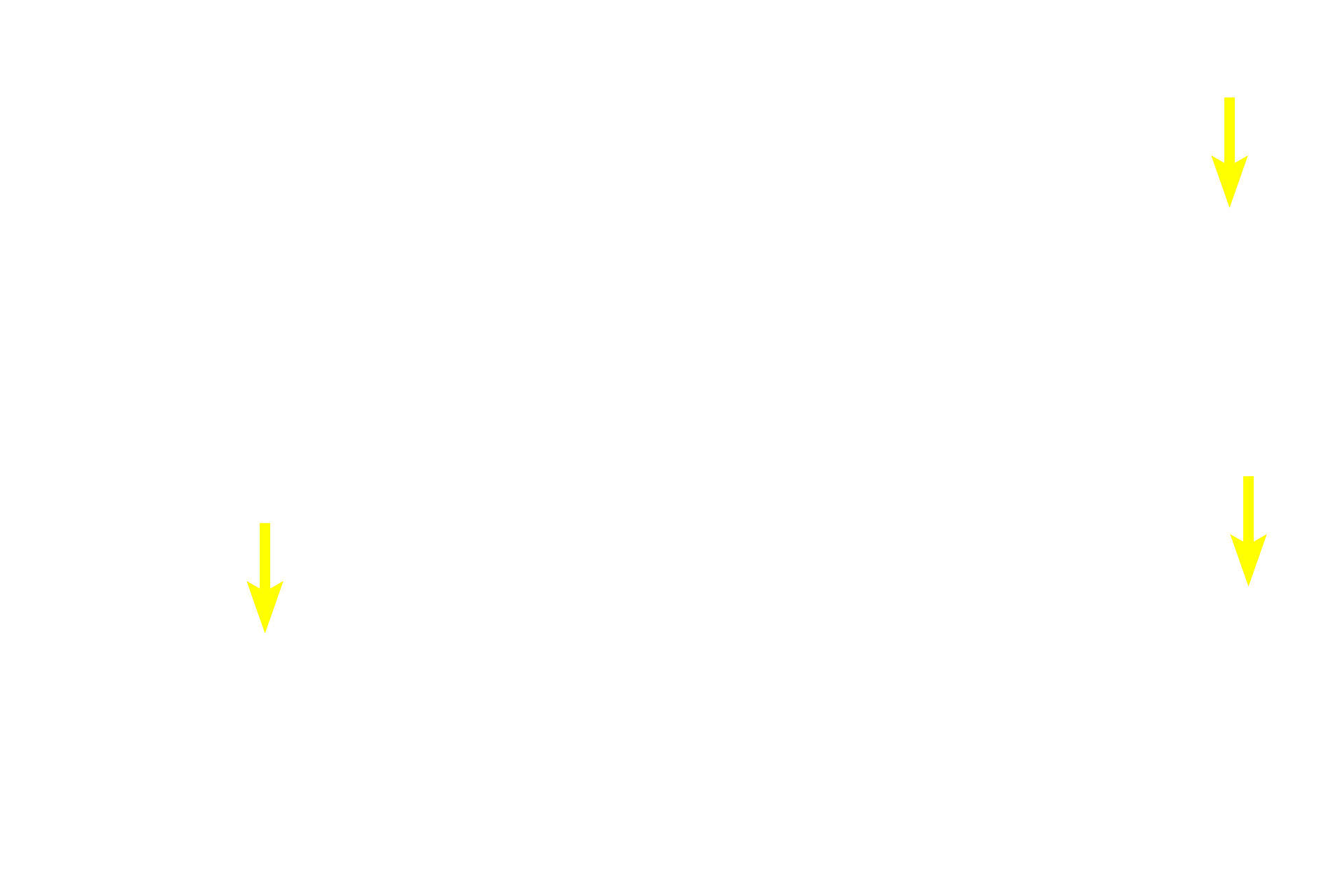 Chromophobes <p>Basophils, the major cell type in this image, consist of gonadotropes (secreting follicle stimulating hormone, FSH, and luteinizing hormone, LH), thyrotrophs (secreting thyroid stimulating hormone, TSH), and adrenocorticotropes (secreting adrenocorticotropic hormone, ACTH). These three cell types, however, cannot be distinguished by routine hematoxylin and eosin staining.  1000x</p>
