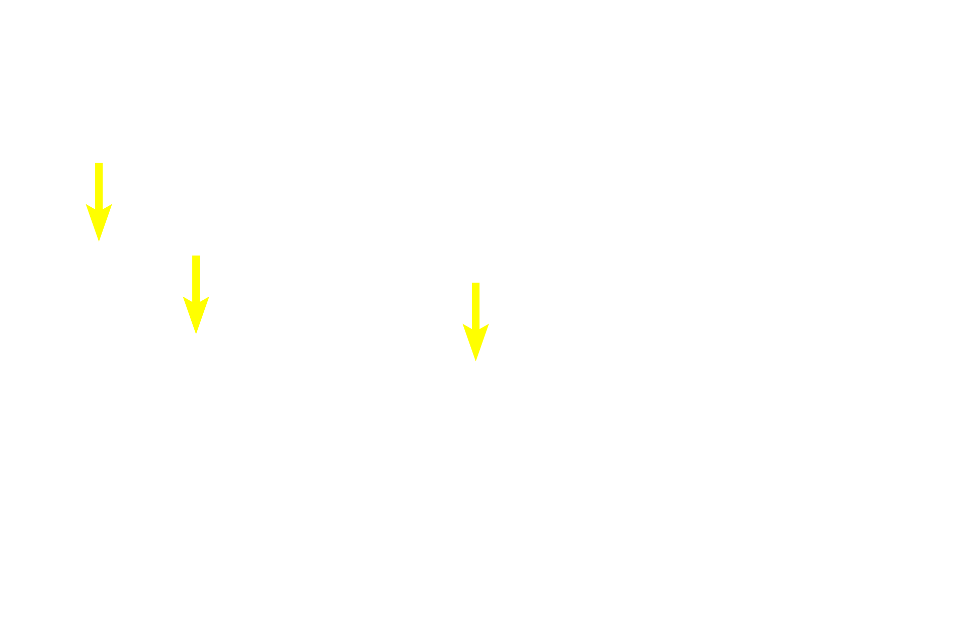 Basophils <p>Acidophils comprise about 70% of the hormone-secreting cells in the adenohypophyis: 50% somatotropes and 15-20% mammotropes.  The remaining 30% of hormone-secreting cells are basophils: 15-20% adenocorticotropes; 10% gonadotropes and 5% thyrotropes.</p>
