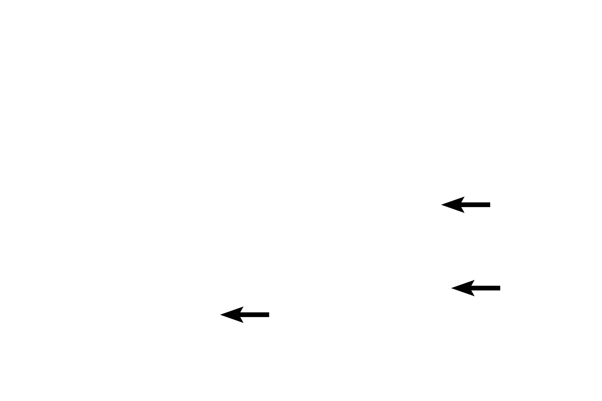 Acidophils <p>Acidophils comprise about 70% of the hormone-secreting cells in the adenohypophyis: 50% somatotropes and 15-20% mammotropes.  The remaining 30% of hormone-secreting cells are basophils: 15-20% adenocorticotropes; 10% gonadotropes and 5% thyrotropes.</p>
