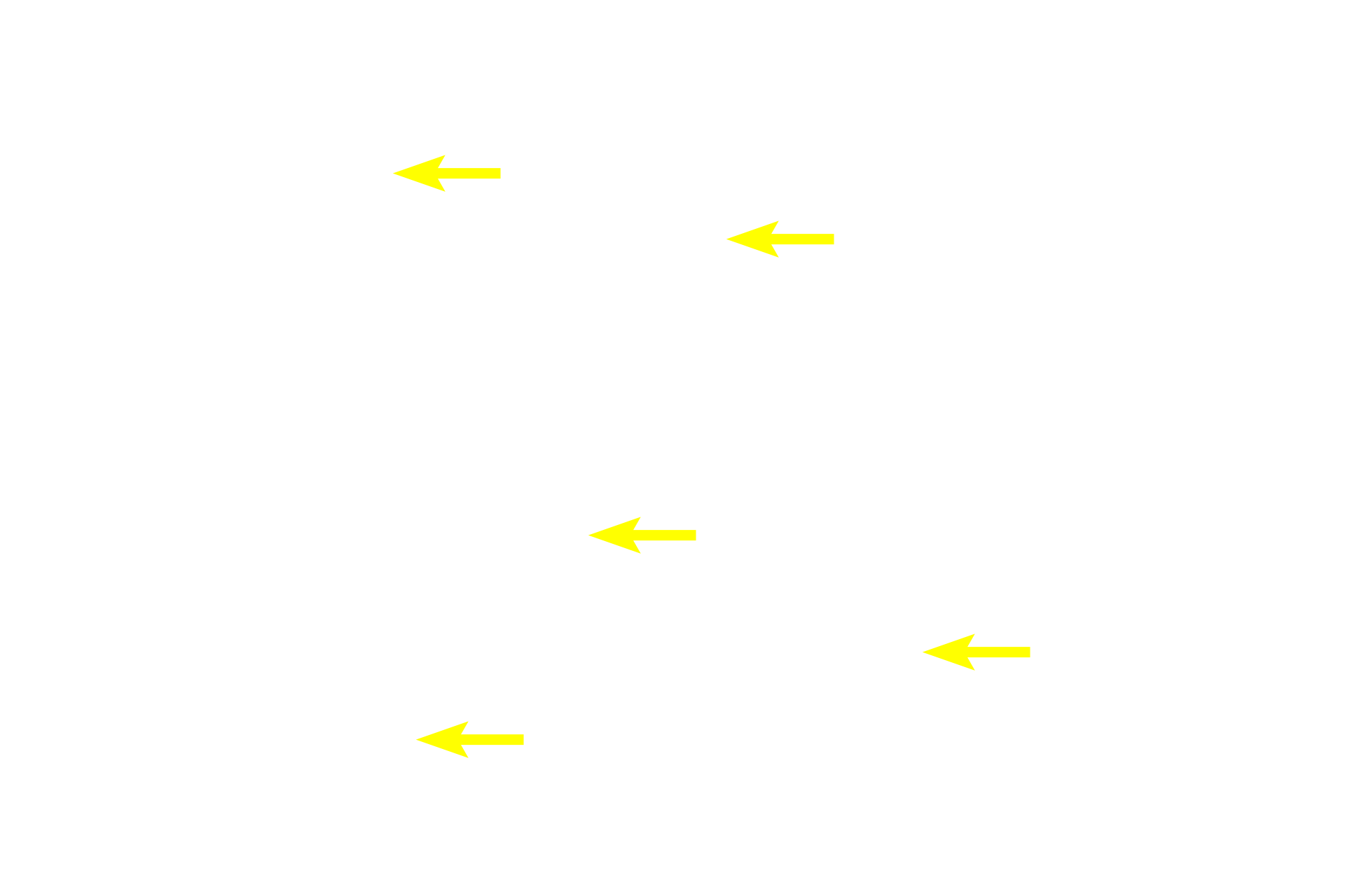 Basophils <p>This Masson stain colors acidophils orange and basophils greenish-purple.  The connective tissue stroma of the gland is stained green.  Tissue processing has resulted in some artifactual separation of the cells.  400x</p>
