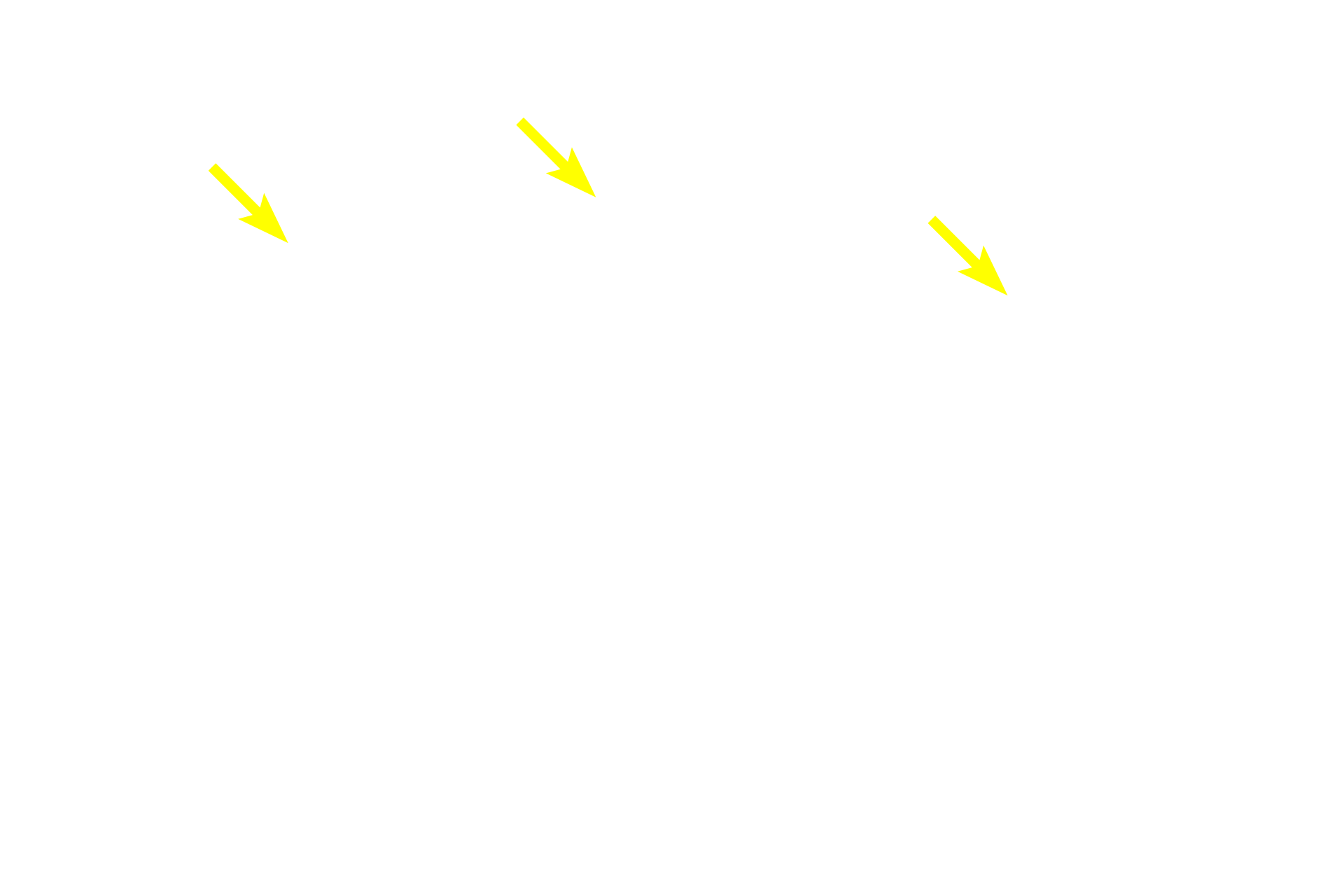 Capillaries with red blood cells <p>This Masson stain colors acidophils orange and basophils greenish-purple.  The connective tissue stroma of the gland is stained green.  Tissue processing has resulted in some artifactual separation of the cells.  400x</p>
