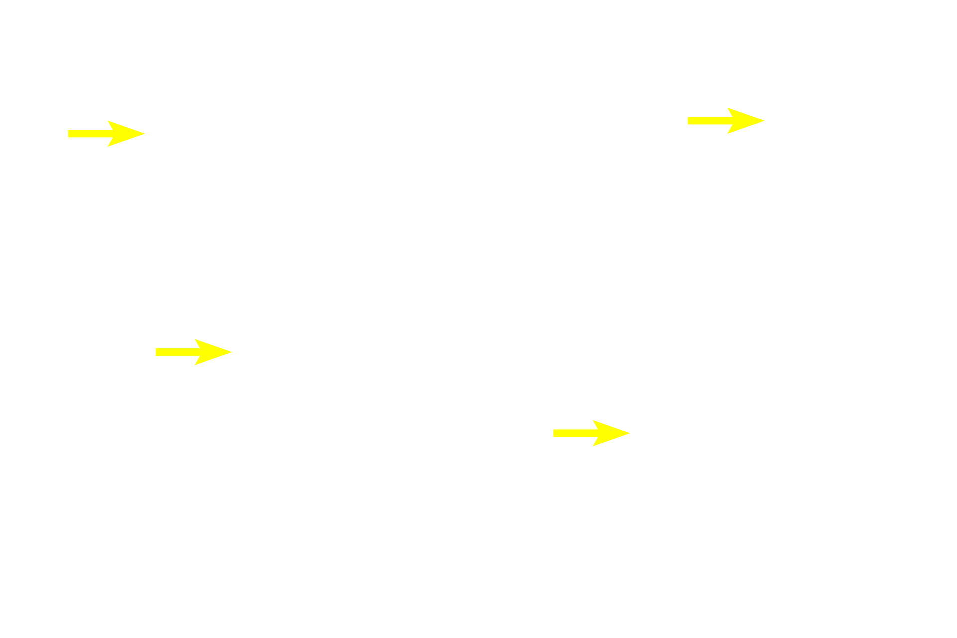 Connective tissue <p>This Masson stain colors acidophils orange and basophils greenish-purple.  The connective tissue stroma of the gland is stained green.  Tissue processing has resulted in some artifactual separation of the cells.  400x</p>
