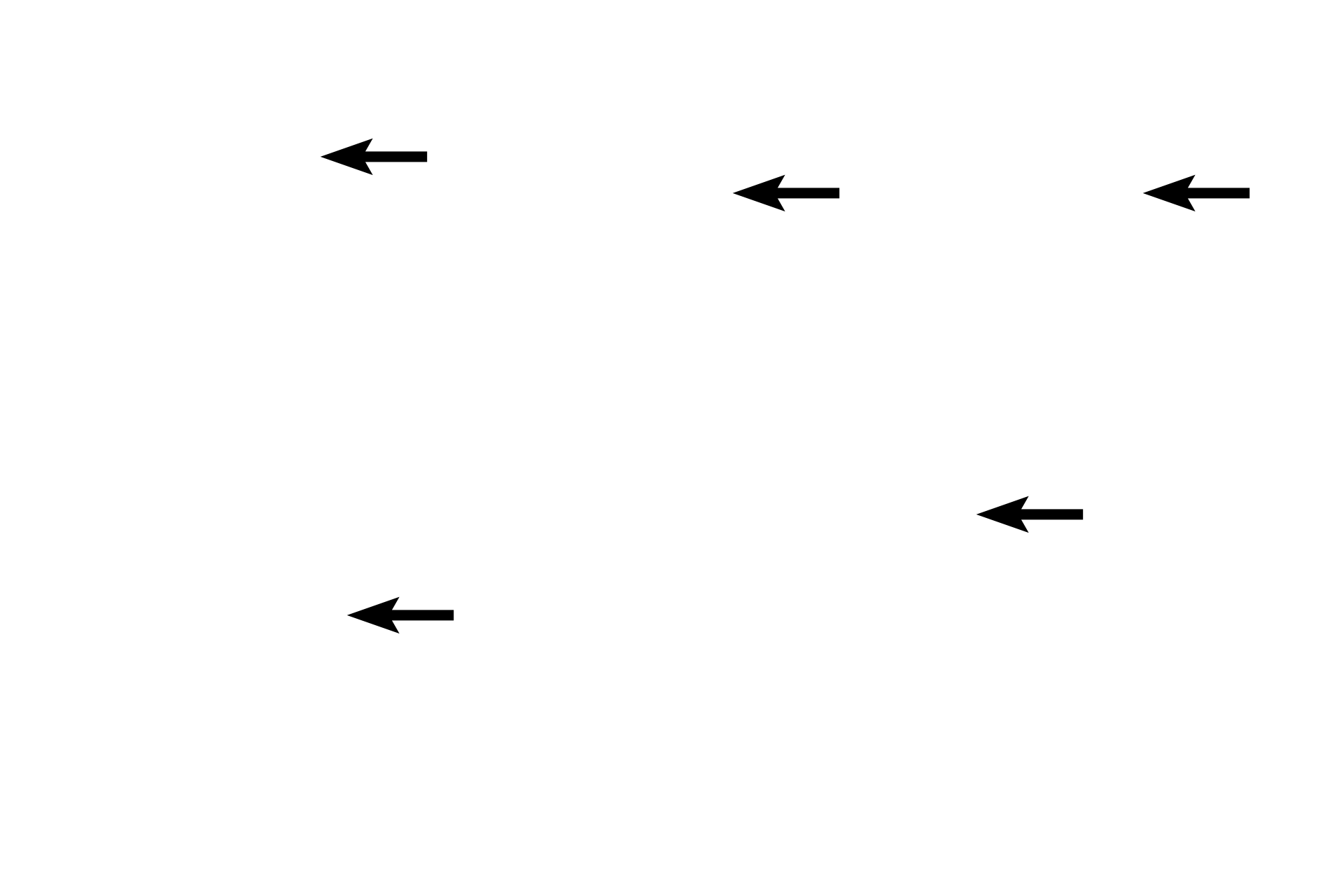  - Thyroglobulin <p>Cells forming thyroid follicles are polarized to secrete thyroglobulin into the center of the follicle for storage, where it is referred to as colloid.  Upon stimulation, thyroglobulin is taken up by follicular cells, broken down into triiodothyronine (T3) and tetraiodothyronine (thyroxine, T4), and released into the blood.</p>
