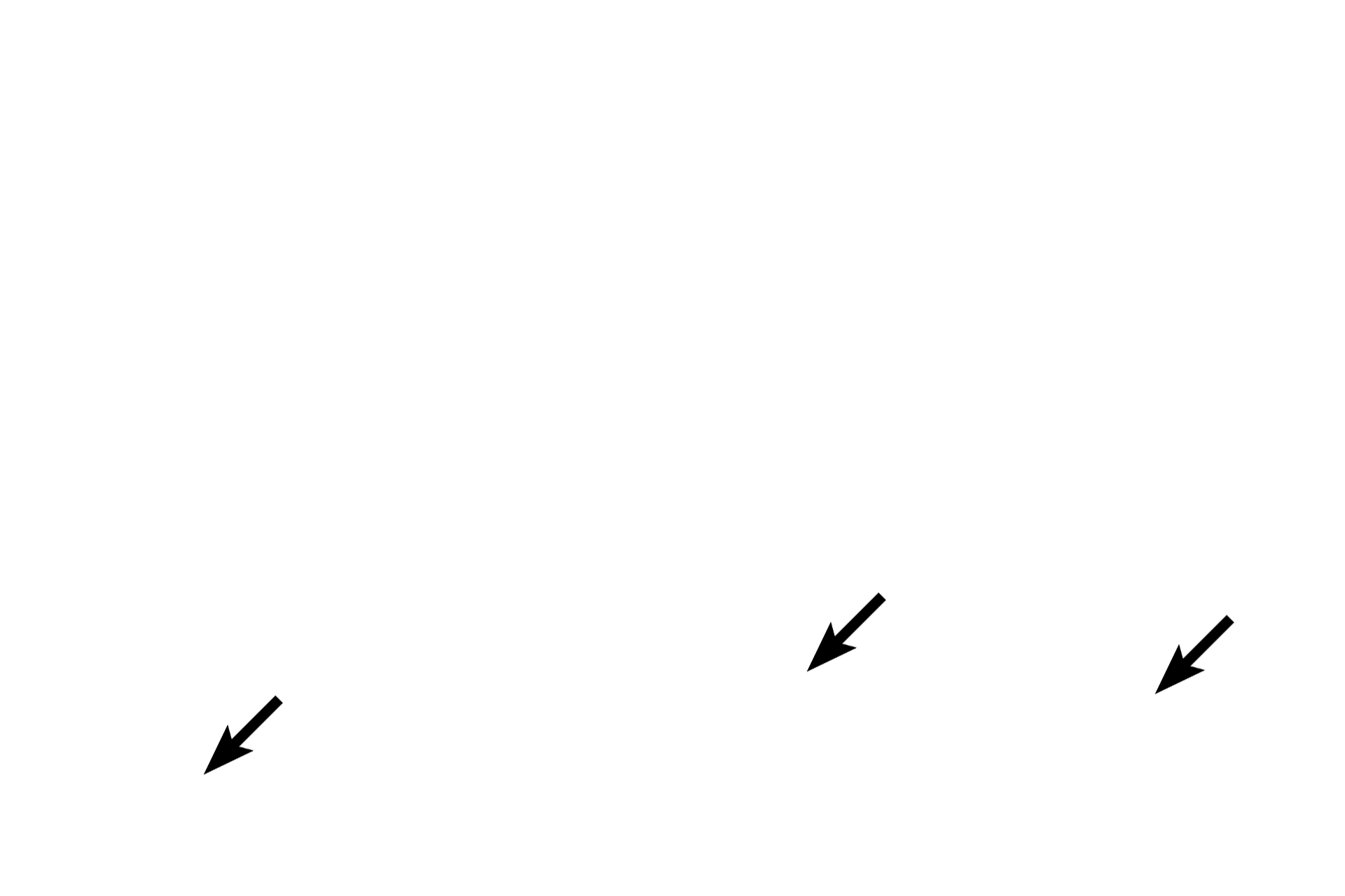 Blood vessels <p>The stroma is composed of loose connective tissue that surrounds and supports the endocrine elements and the blood vessels.”</p>
