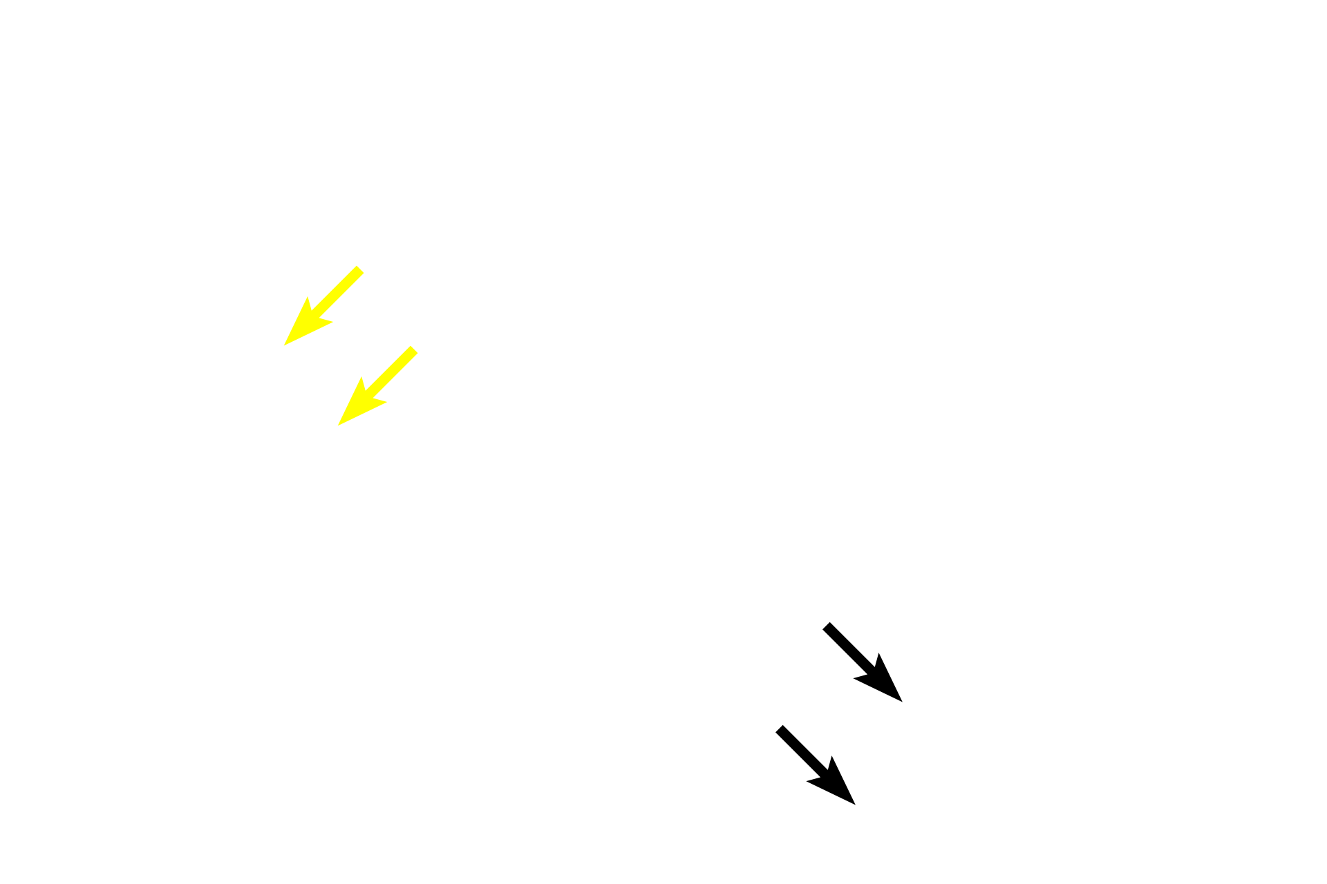  - Follicle (principal) cells > <p>The activity of follicle cells, also referred to as principal cells, is controlled by thyroid stimulating hormone (TSH) secreted by thyrotropes in the adenophypophysis.  Active follicle cells have a columnar shape (yellow arrows); inactive cells are squamous (white arrows); intermediate- activity cells are cuboidal (black arrows).  Follicle cell activity varies, even within the same follicle.</p>
