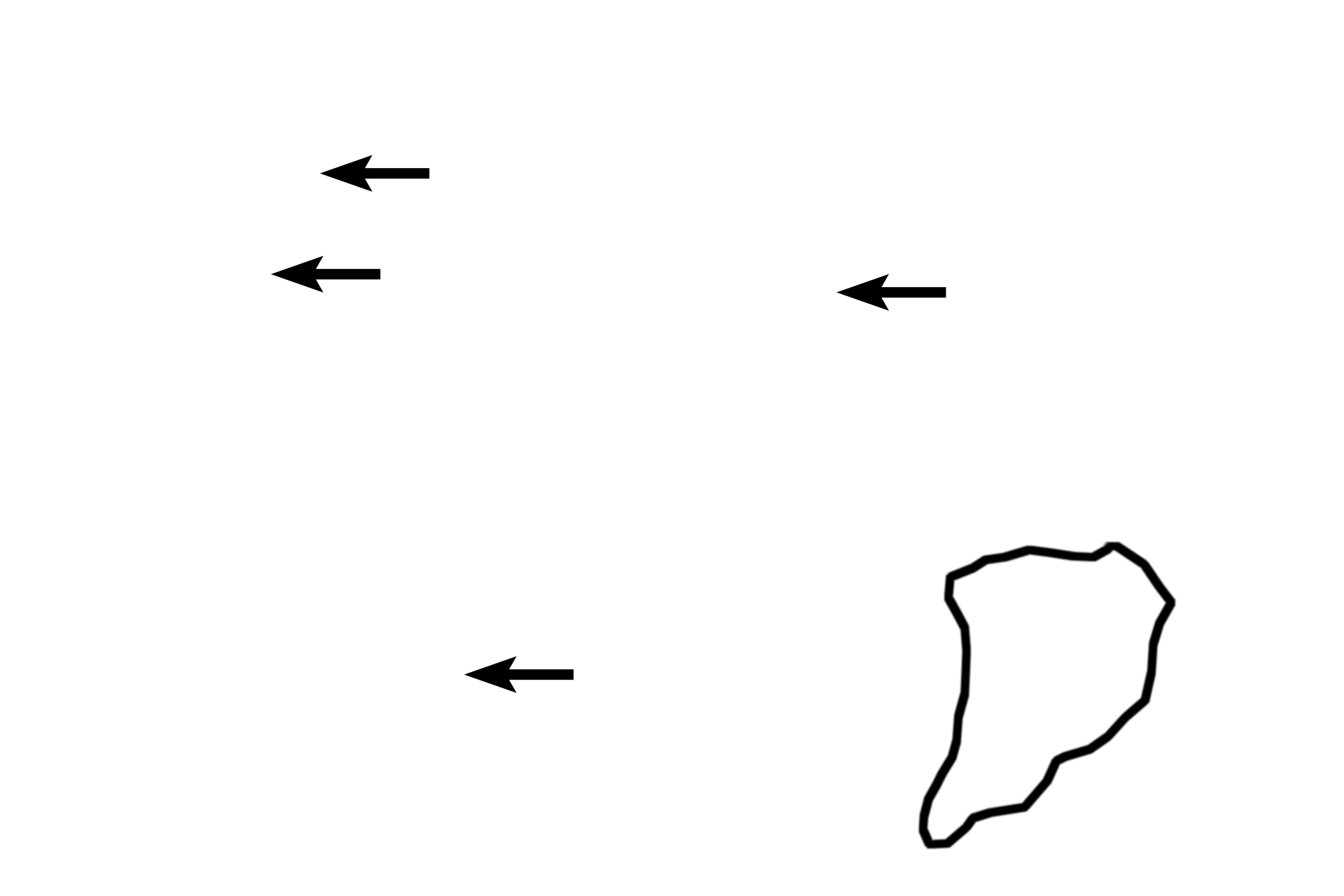 Parafollicular (clear) cells > <p>Parafollicular cells are also referred to as clear cells as the staining of their cytoplasm contrasts with that of the more basophilic-staining cytoplasm of the follicle cells.  Parafollicular cells’ secretion of calcitonin is both regulated and controlled by blood calcium levels. Parafolllicular cells are found in the follicular epithelium as well as in small clusters in the connective tissue between follicles.</p>
