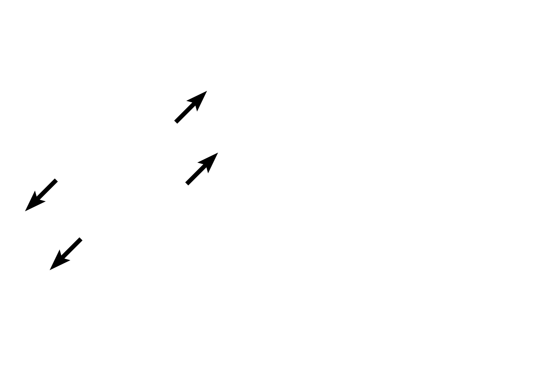  - Inactive follicle cells <p>These images compare two follicles at different stages of activity: low activity (left) and high activity (right).  Follicular epithelium varies in height depending on activity, with more active cells being columnar.  A tall, active, follicular epithelium indicates that cells are either actively secreting thyroglobulin into the follicular lumen or are resorbing thyroglobulin for processing into thyroid hormones.</p>
