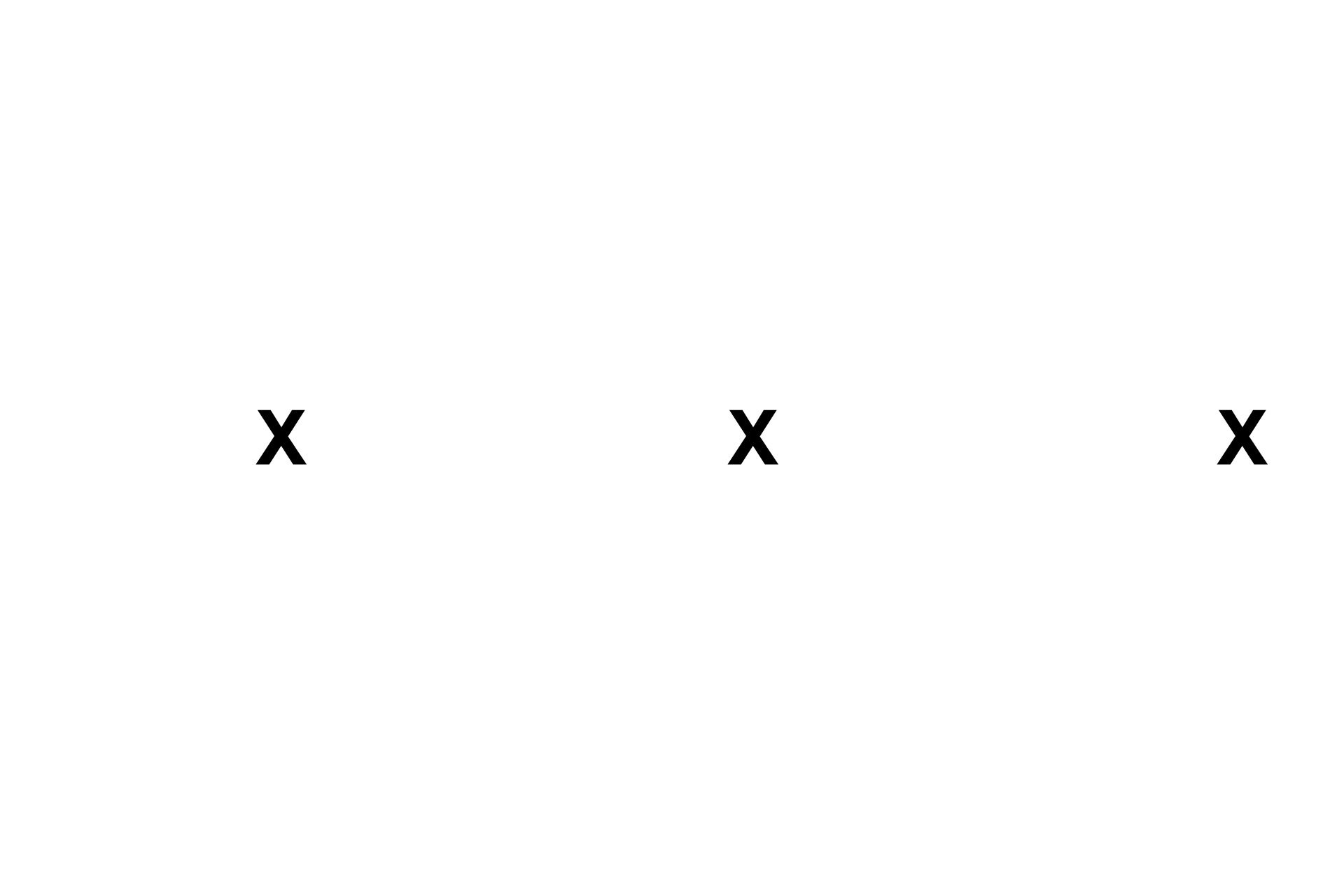 Thyroglobulin <p>The increased height of the follicle cells results from a greater abundance of synthetic and protein-processing organelles.  Also present are granules, which are involved either in the transport and release of thyroglobulin into the lumen or resorption and processing of thyroglobulin to release T3 and T4 into the surrounding capillaries.</p>
