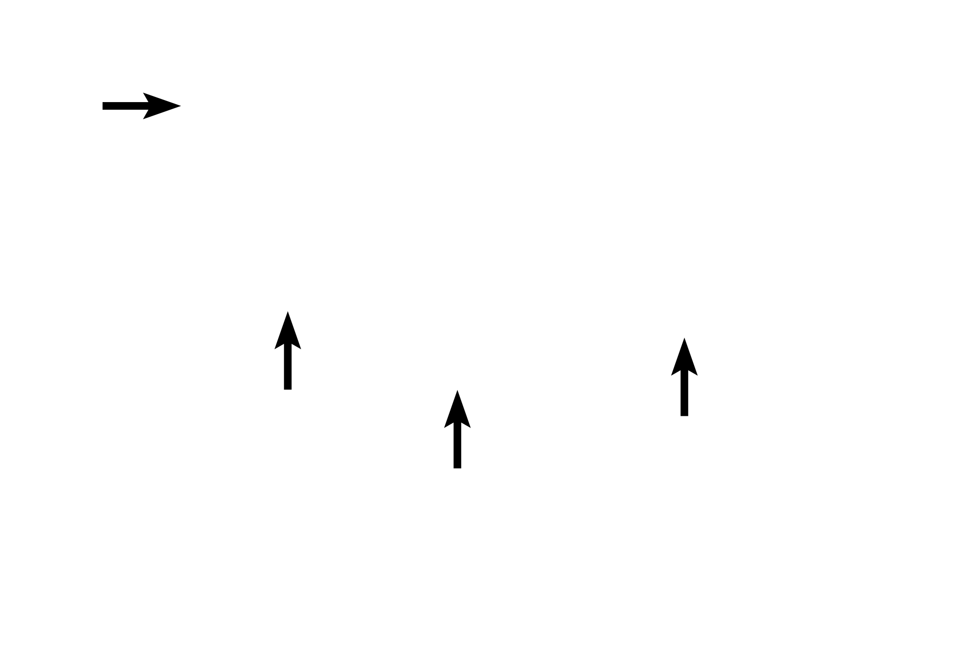 Parafollicular cells <p>Parafollicular cells or C cells are located both in the interfollicular connective tissue and within the basal lamina of the follicular epithelium (seen here). These cells are separated from the thyroglobulin by processes from adjacent follicle cells extending over the parafollicular cells.  Parafollicular cells have a pale cytoplasm with secretory granules containing calcitonin.  Calcitonin secretion lowers, and is regulated by, blood calcium levels.  1000x</p>
