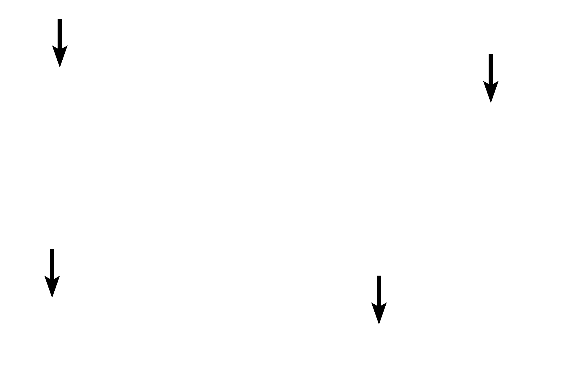 Red blood cells <p>Neutrophils readily move from the blood to sites of tissue inflammation, infection and trauma. They form the first line of defense in the body against invading microorganisms and, along with macrophages, are the major phagocytic cells in tissues. Their weakly-stained specific granules contain a number of enzymes that aid in their migration through tissue as well as in their phagocytic function. The less numerous azurophilic (blue-staining) granules are common to all granulocytes.</p>
