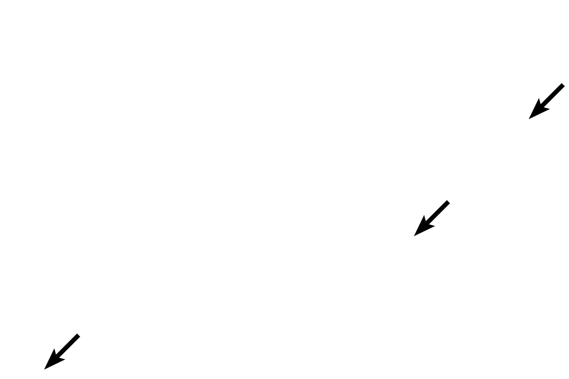 Platelets <p>Neutrophils readily move from the blood to sites of tissue inflammation, infection and trauma. They form the first line of defense in the body against invading microorganisms and, along with macrophages, are the major phagocytic cells in tissues. Their weakly-stained specific granules contain a number of enzymes that aid in their migration through tissue as well as in their phagocytic function. The less numerous azurophilic (blue-staining) granules are common to all granulocytes.</p>
