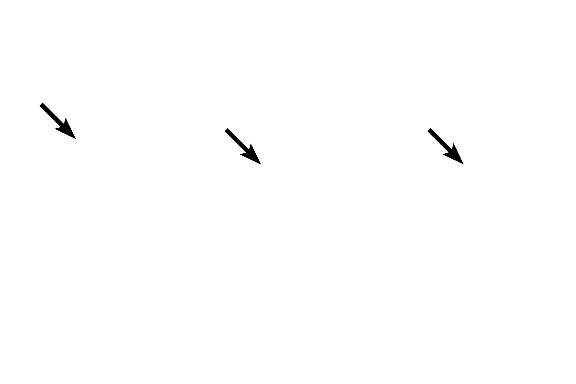 Nucleus <p>Eosinophils are granular leucocytes with heterochromatic, bilobed nuclei and bright eosinophilic granules that fill the cytoplasm. Like neutrophils, eosinophils function in tissues and readily exit the blood stream. Eosinophils play a role in allergic reactions and parasitic infections as well as phagocytosis. 1000x</p>
