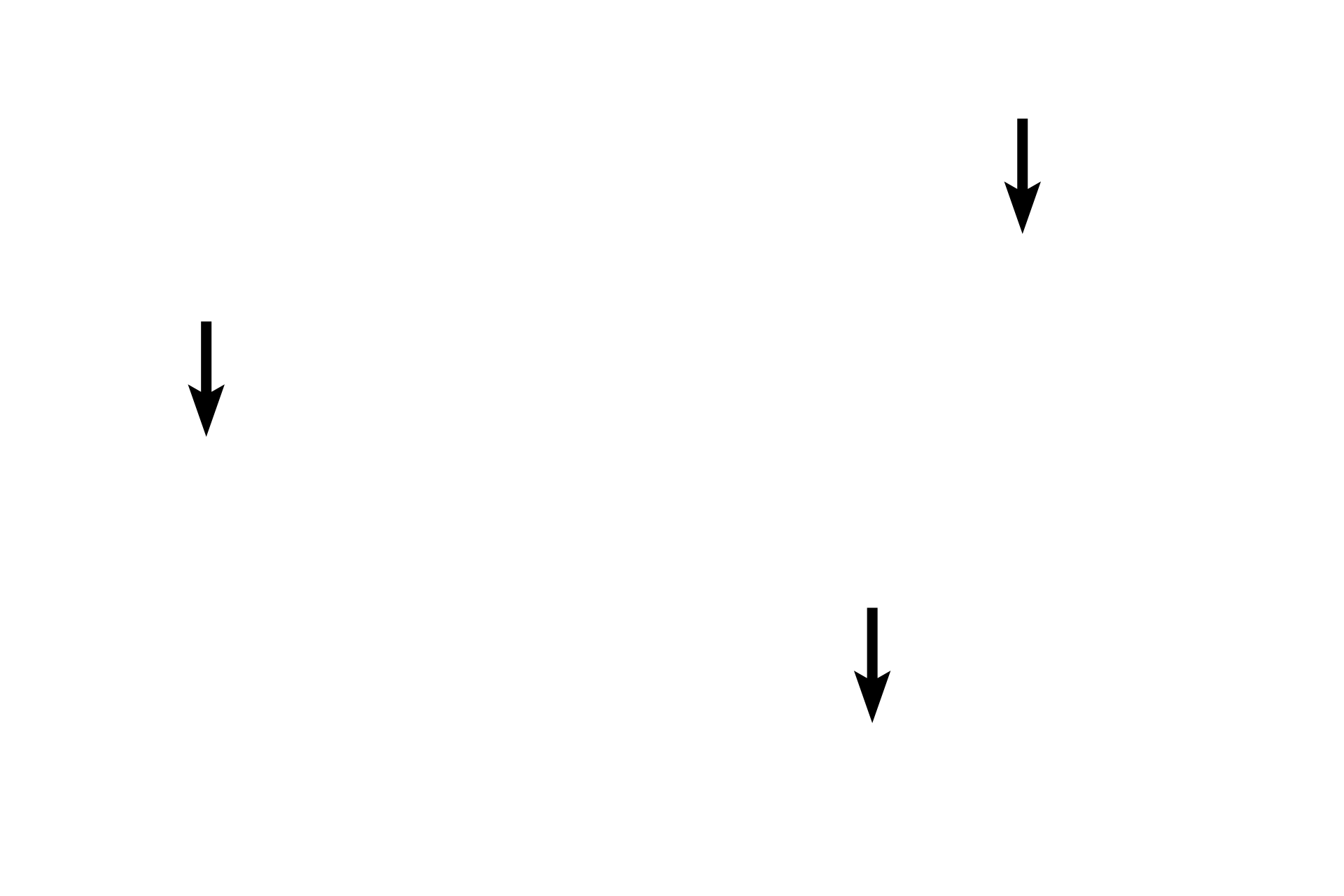 Red blood cells <p>A basophil is a granular leucocyte with a bi-lobed, heterochromatic nucleus, which is often obscured by the intensely stained large basophilic granules in the cytoplasm. Basophils are the least numerous of the granulocytes. Basophils are the least numerous of the blood cells and, while functionally similar to mast cells, they have somewhat different functions as well developmental origins. 1000x</p>
