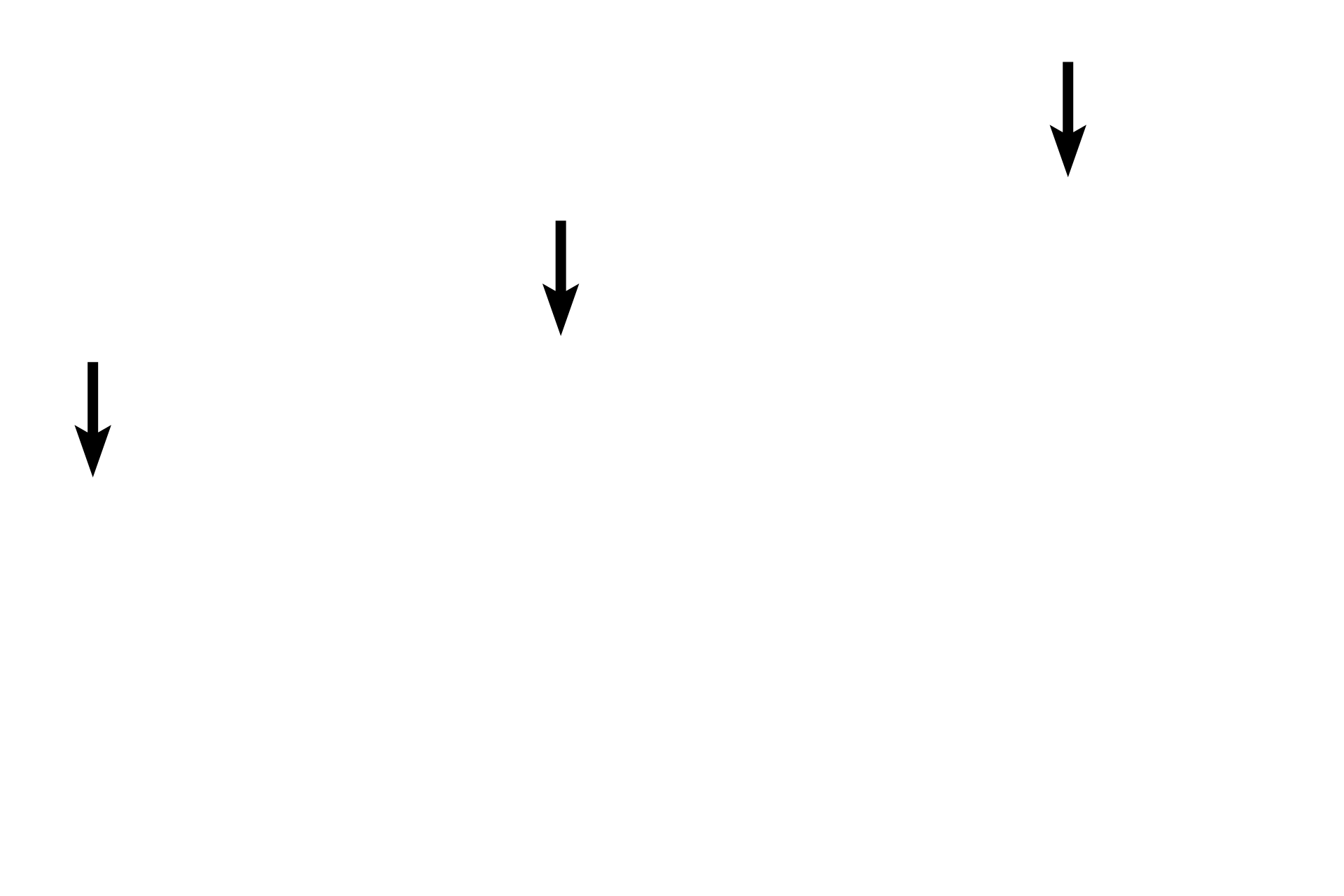 Platelets <p>A basophil is a granular leucocyte with a bi-lobed, heterochromatic nucleus, which is often obscured by the intensely stained large basophilic granules in the cytoplasm. Basophils are the least numerous of the granulocytes. Basophils are the least numerous of the blood cells and, while functionally similar to mast cells, they have somewhat different functions as well developmental origins. 1000x</p>
