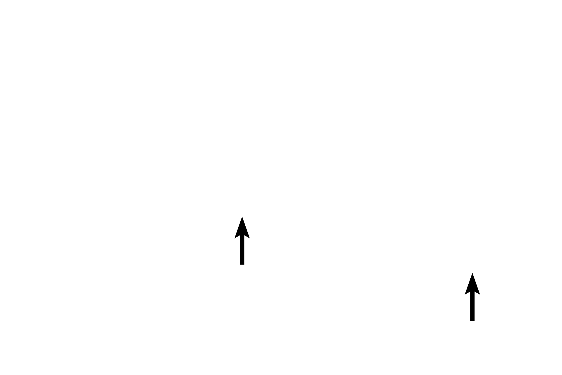 Red blood cells <p>Monocytes are large agranulocytes with a nucleus that is usually horseshoe shaped and eccentrically located. The cytoplasm is abundant, blue-grey and grainy. Monocytes only become active after they migrate into the connective tissues, where they differentiate into phagocytic cells, such as macrophages, osteoclasts and Kupffer cells. 1000x</p>
