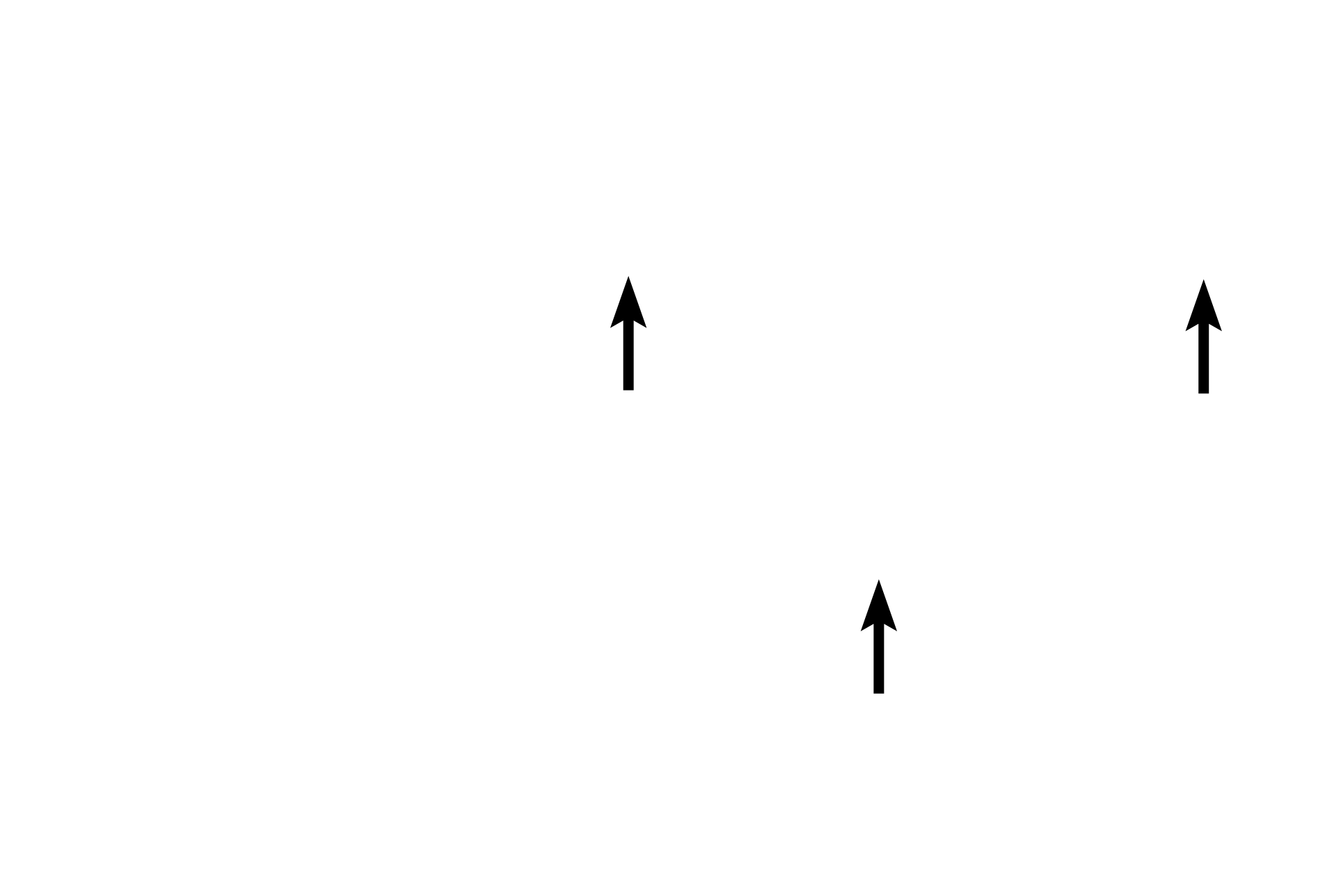 Platelets <p>Monocytes are large agranulocytes with a nucleus that is usually horseshoe shaped and eccentrically located. The cytoplasm is abundant, blue-grey and grainy. Monocytes only become active after they migrate into the connective tissues, where they differentiate into phagocytic cells, such as macrophages, osteoclasts and Kupffer cells. 1000x</p>
