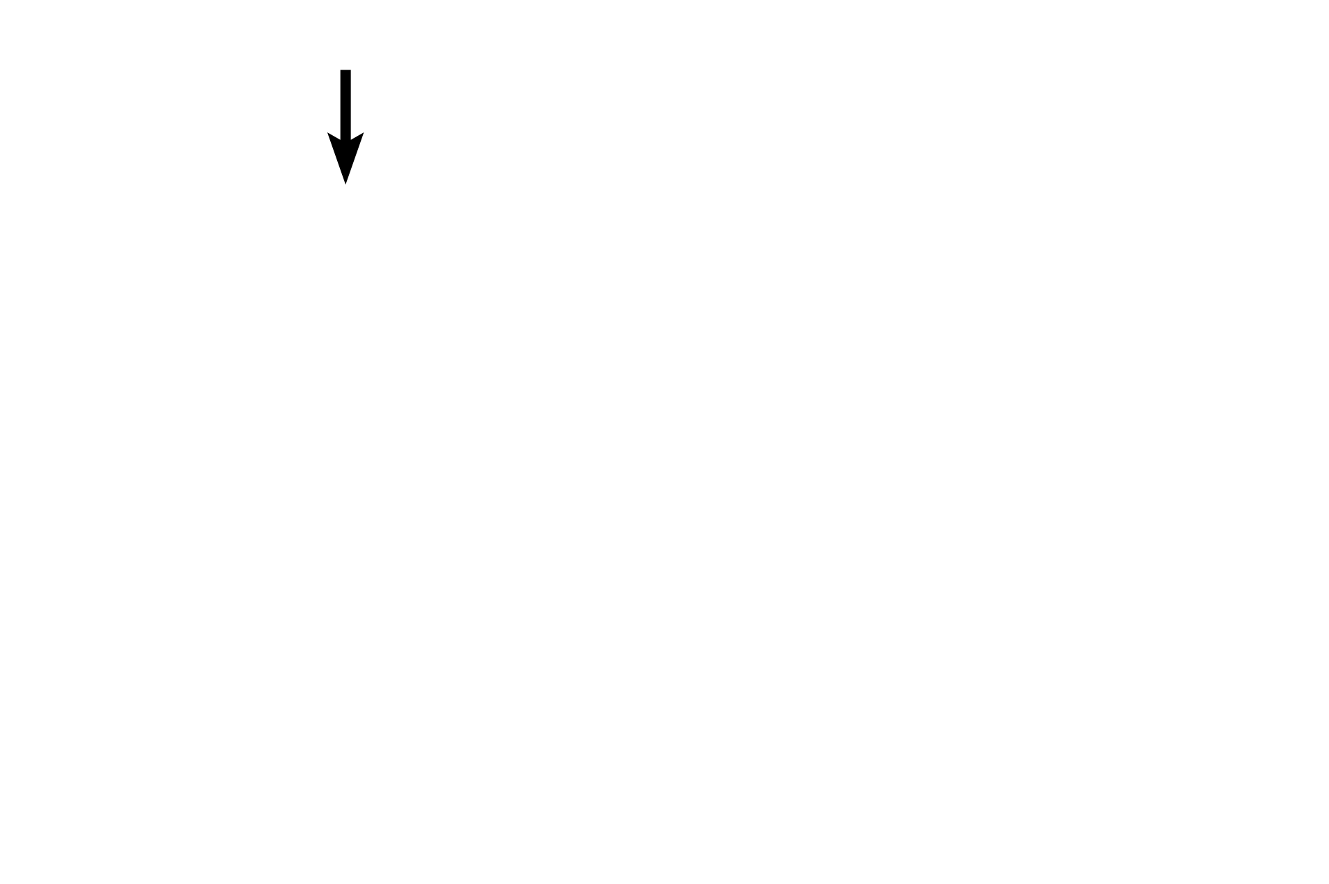 Small lymphocyte <p>Lymphocytes are agranular leucocytes with a spherical, heterochromatic nucleus and very little cytoplasm. While small lymphocytes with minimal cytoplasm predominate in blood, medium and large lymphocytes with larger nuclei and more abundant cytoplasm are also present. Lymphocytes can be either T cells or B cells, however, these two varieties cannot be distinguished without special immunospecific staining methods. In tissues, B cells further differentiate into antibody-secreting plasma cells. 1000x</p>
