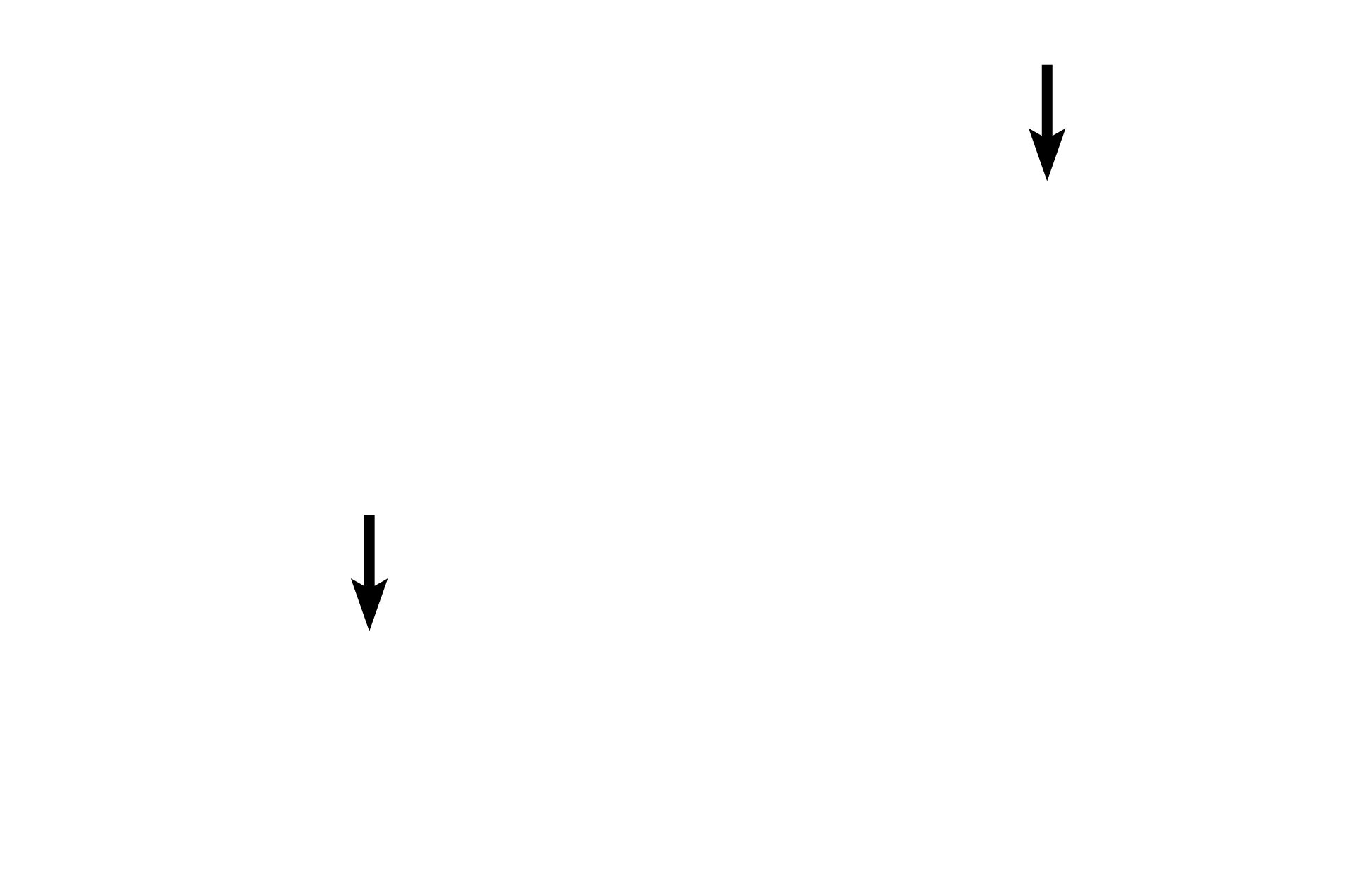 Medium lymphocytes <p>Lymphocytes are agranular leucocytes with a spherical, heterochromatic nucleus and very little cytoplasm. While small lymphocytes with minimal cytoplasm predominate in blood, medium and large lymphocytes with larger nuclei and more abundant cytoplasm are also present. Lymphocytes can be either T cells or B cells, however, these two varieties cannot be distinguished without special immunospecific staining methods. In tissues, B cells further differentiate into antibody-secreting plasma cells. 1000x</p>
