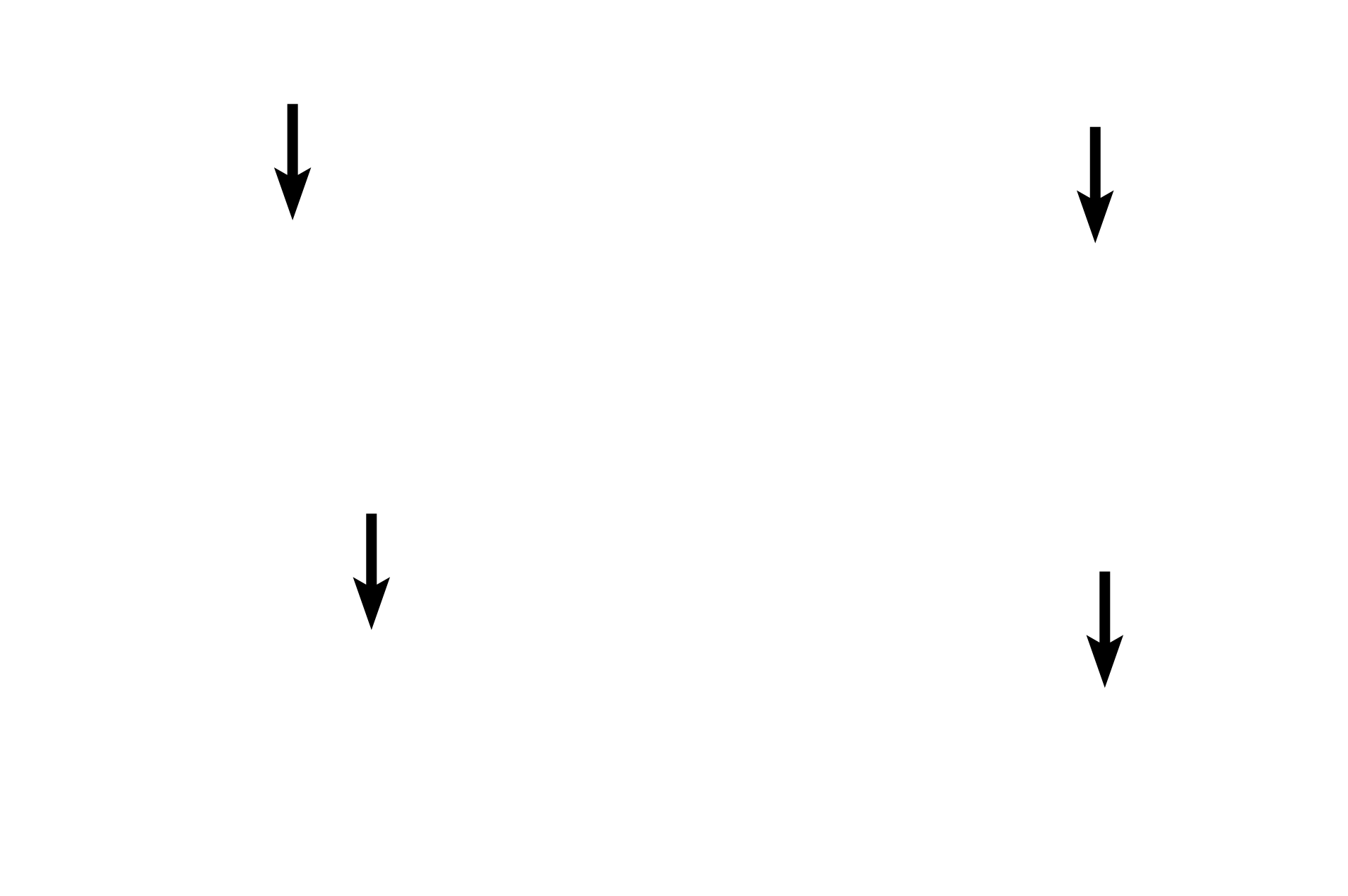 Cytoplasm <p>Lymphocytes are agranular leucocytes with a spherical, heterochromatic nucleus and very little cytoplasm. While small lymphocytes with minimal cytoplasm predominate in blood, medium and large lymphocytes with larger nuclei and more abundant cytoplasm are also present. Lymphocytes can be either T cells or B cells, however, these two varieties cannot be distinguished without special immunospecific staining methods. In tissues, B cells further differentiate into antibody-secreting plasma cells. 1000x</p>
