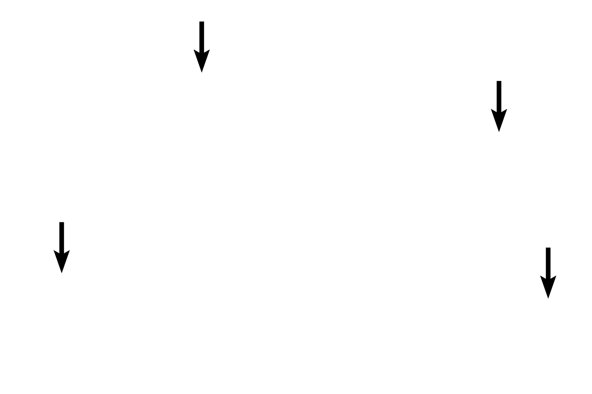 Red blood cells <p>Lymphocytes are agranular leucocytes with a spherical, heterochromatic nucleus and very little cytoplasm. While small lymphocytes with minimal cytoplasm predominate in blood, medium and large lymphocytes with larger nuclei and more abundant cytoplasm are also present. Lymphocytes can be either T cells or B cells, however, these two varieties cannot be distinguished without special immunospecific staining methods. In tissues, B cells further differentiate into antibody-secreting plasma cells. 1000x</p>

