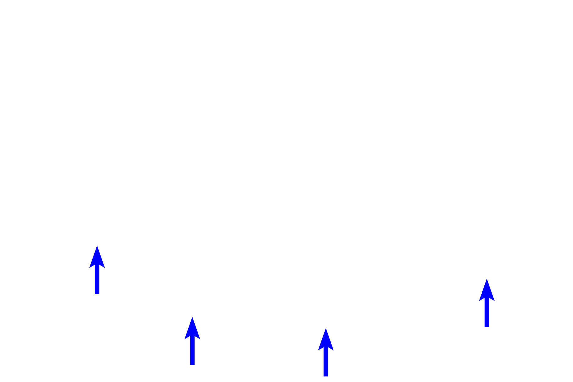 Artifactual space > <p>This artifactual space was created during tissue processing when bone marrow shrank away from the bony shaft.</p>
