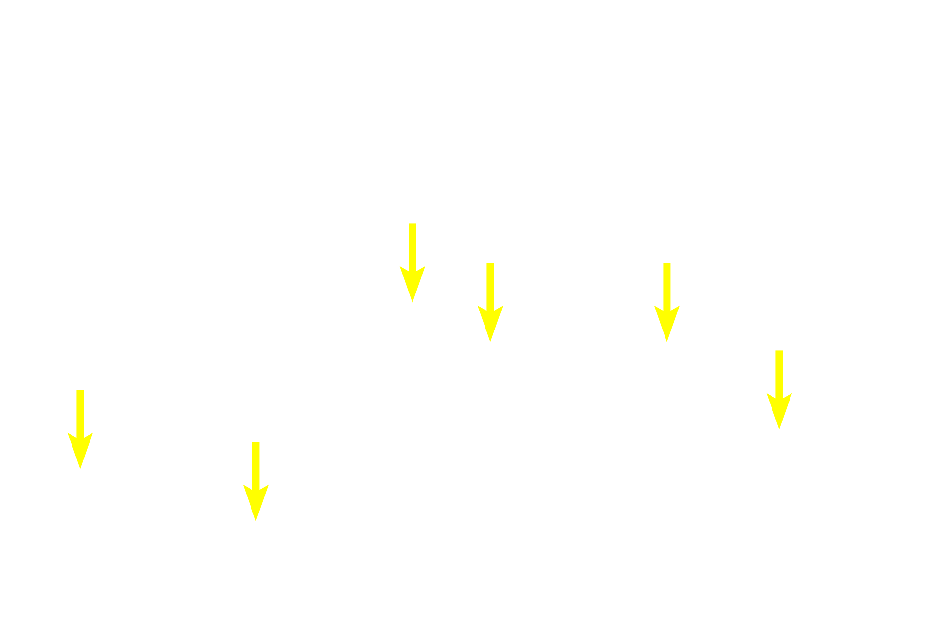 Sinusoids <p>Blood cells exit hemopoietic tissue to enter the circulatory system by passing through the walls of thin-walled sinusoids. Mature, non-nucleated red blood cells as well as nucleated white blood cells are visible in these sinusoids.</p>
