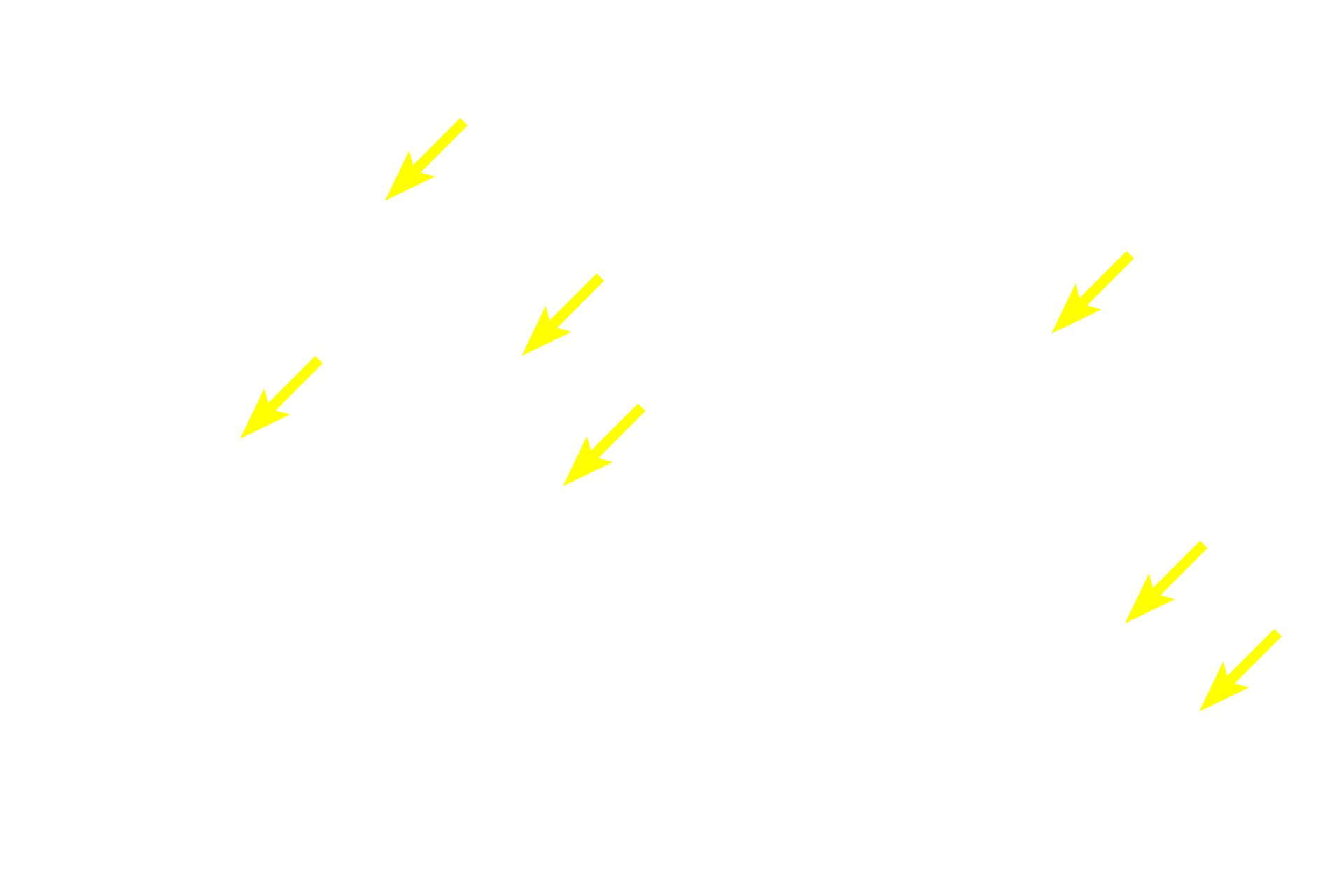 Sinusoids <p>In this adult bone marrow image, the lumens of some of the sinusoids can be seen because they are not filled with blood cells. The constituents of adult red bone marrow seen in the previous image are also seen here. 400x</p>
