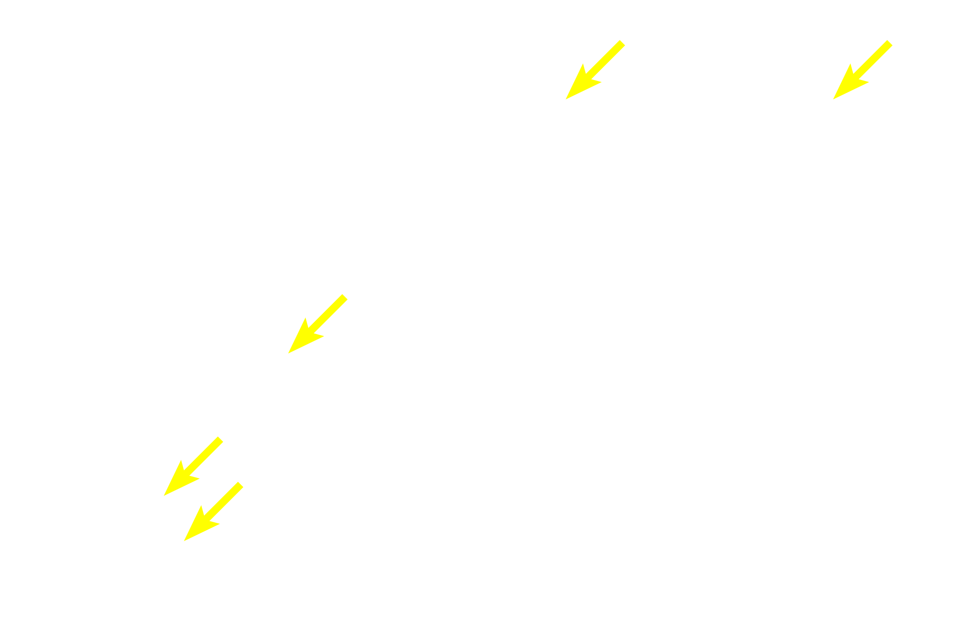 Megakaryocytes <p>In this adult bone marrow image, the lumens of some of the sinusoids can be seen because they are not filled with blood cells. The constituents of adult red bone marrow seen in the previous image are also seen here. 400x</p>
