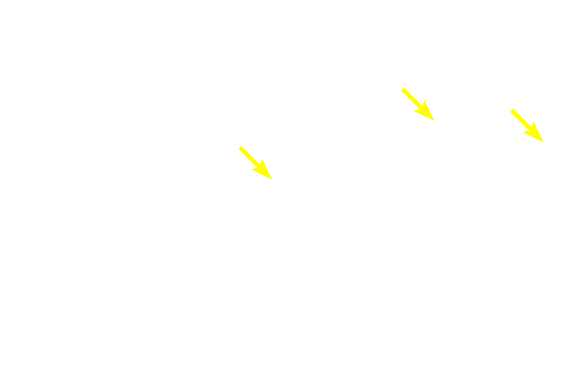  - Secretory granules <p>The secretory portion of the gland is composed of three cell types, two of which are secretory:  clear cells, which contain abundant glycogen, and dark cells, which contain secretory granules.  Both secretory cell types lie on the basement membrane.  1000x</p>
