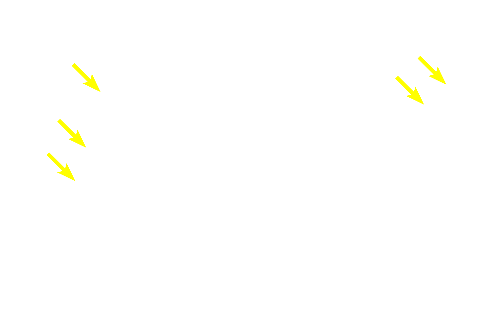 Hair follicles <p>Apocrine sweat glands are characterized by their large size and wide lumens.  The ducts of these glands open into hair follicles near those of the sebaceous glands.  Like eccrine sweat glands, apocrine sweat glands are classified as simple coiled tubular glands, but contrary to their name, they secrete by the merocrine mode.  Apocrine sweat glands are located in the anal (shown here), areolar and axillary regions.  100x</p>
