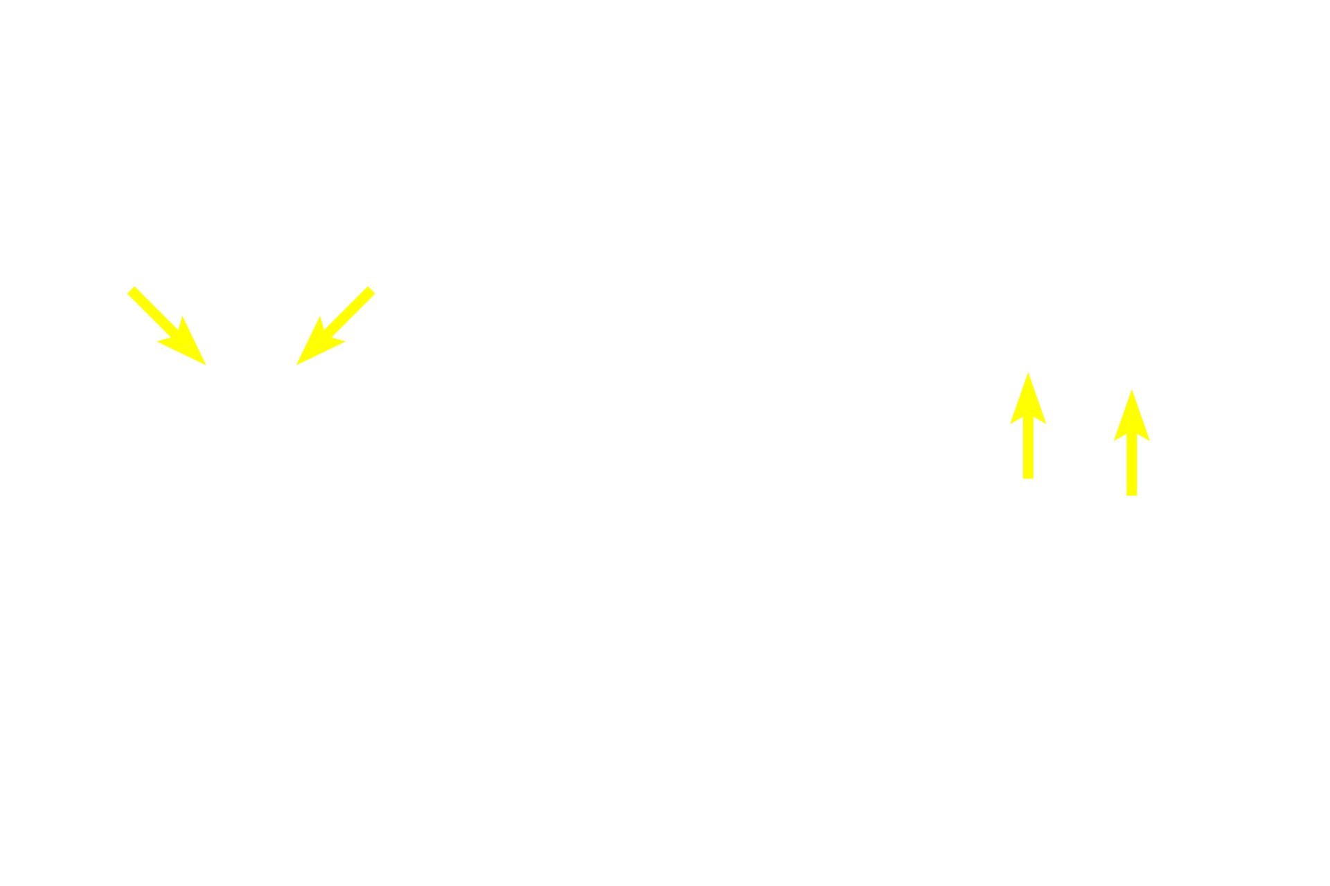 Sebaceous glands <p>Apocrine sweat glands are characterized by their large size and wide lumens.  The ducts of these glands open into hair follicles near those of the sebaceous glands.  Like eccrine sweat glands, apocrine sweat glands are classified as simple coiled tubular glands, but contrary to their name, they secrete by the merocrine mode.  Apocrine sweat glands are located in the anal (shown here), areolar and axillary regions.  100x</p>
