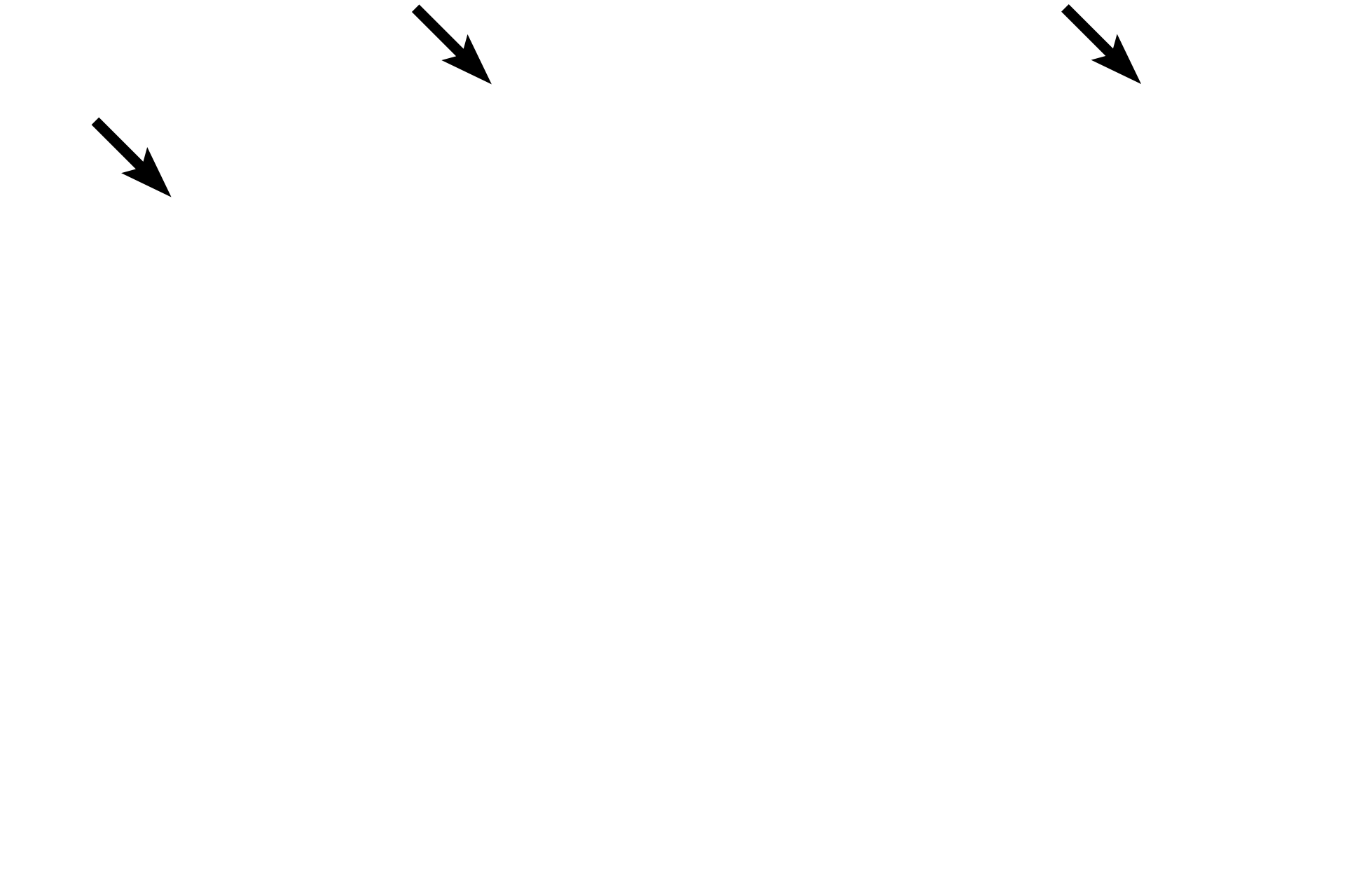 Epidermis <p>Apocrine sweat glands are characterized by their large size and wide lumens.  The ducts of these glands open into hair follicles near those of the sebaceous glands.  Like eccrine sweat glands, apocrine sweat glands are classified as simple coiled tubular glands, but contrary to their name, they secrete by the merocrine mode.  Apocrine sweat glands are located in the anal (shown here), areolar and axillary regions.  100x</p>
