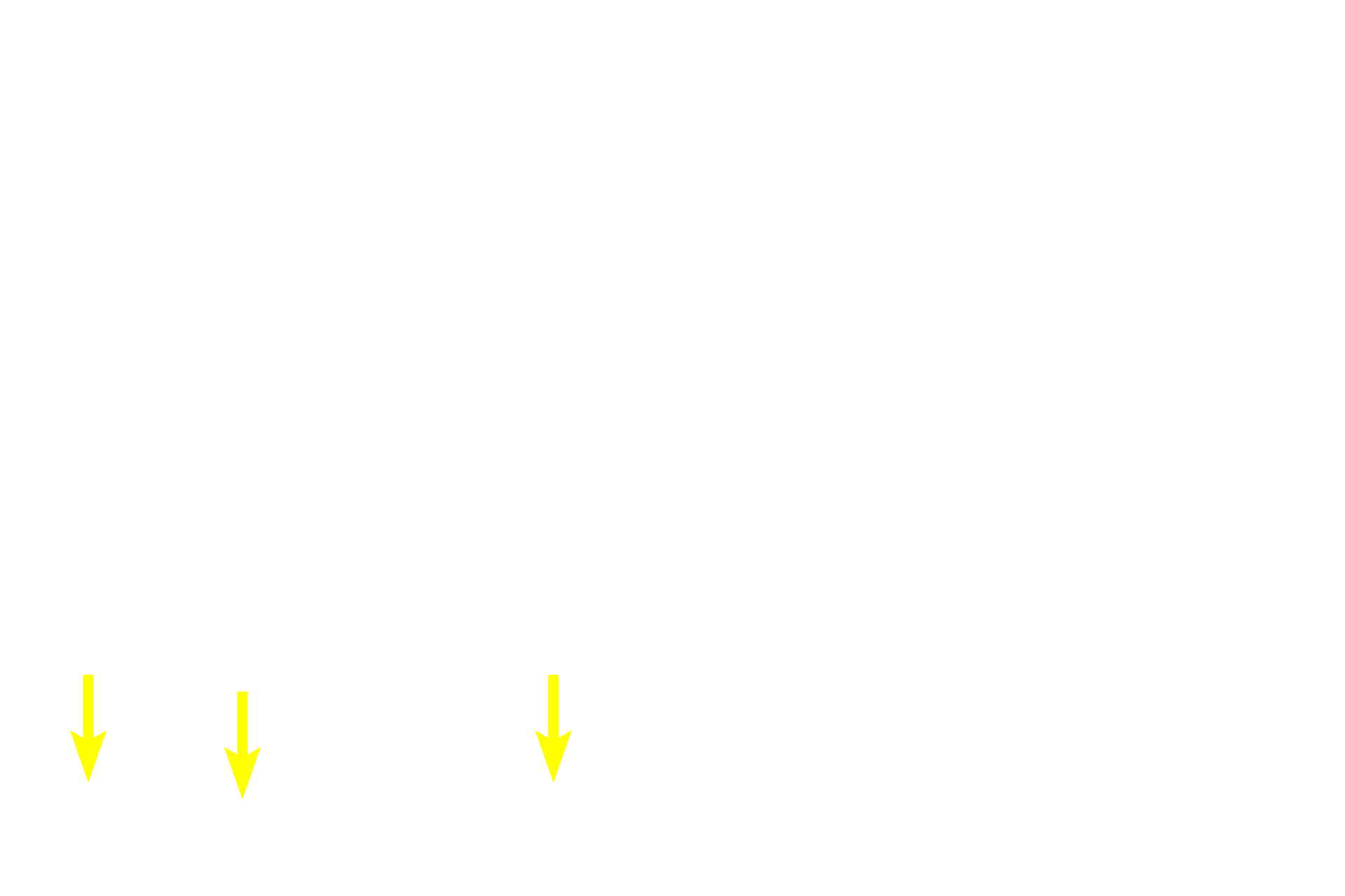 Sebum <p>Cells at the periphery of the acini proliferate and, as they are pushed toward the center of the acinus, accumulate lipid (sebum) and degenerate, eventually filling the center of the acinus.  These dead cells, and the sebum they contain, are released into a short duct opening onto the hair shaft.</p>
