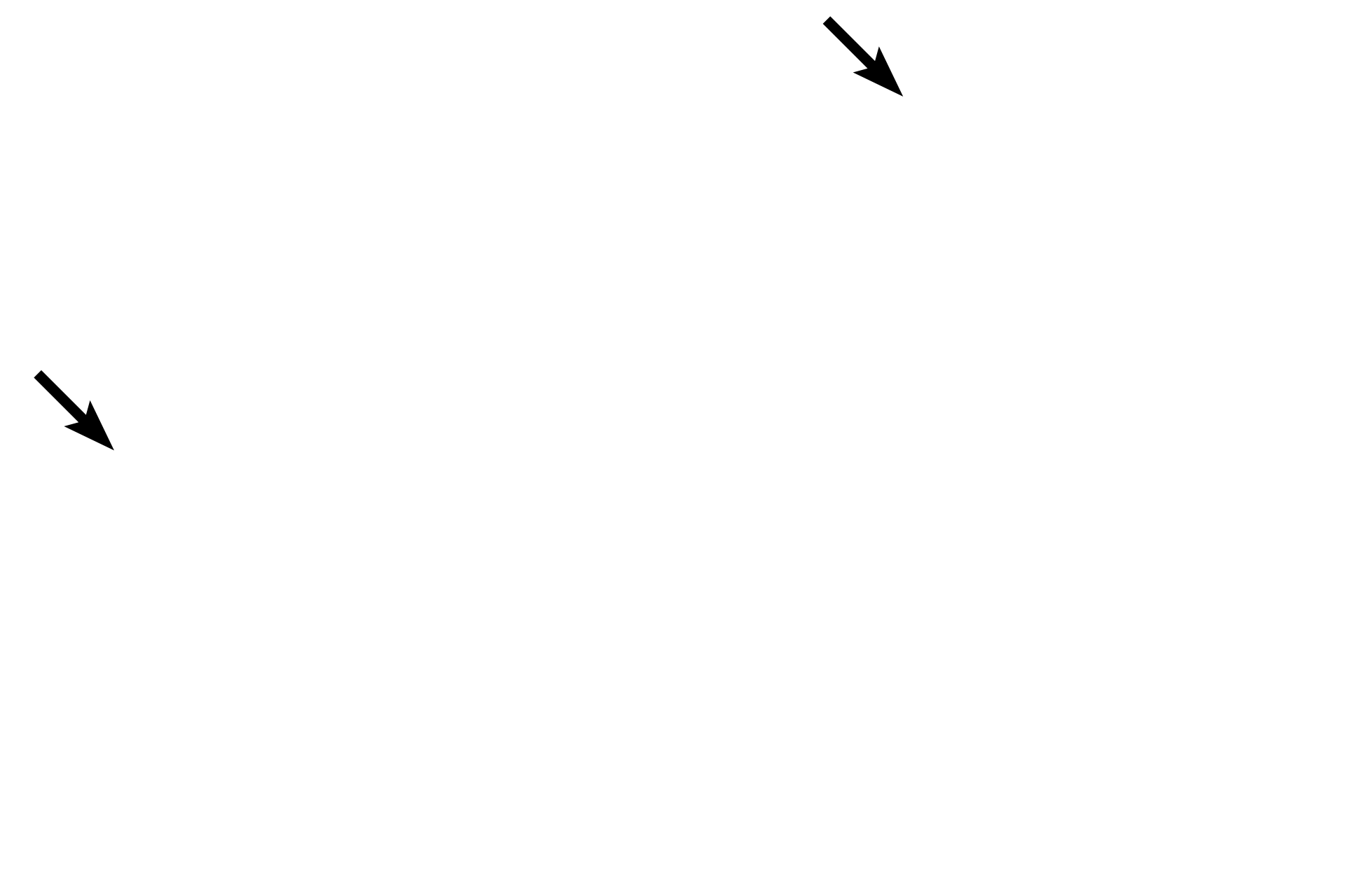 Eponychium <p>The fingernail (nail plate) corresponds to stratum corneum and rests on a nail bed of strata basale and spinosum.  The nail root lies in an epidermal fold, whose stratum corneum forms the eponychium (cuticle).  Beneath the root is the nail matrix, the germinative portion of the nail.  The hyponychium, a thickened epidermis, secures the nail at the fingertip.  Upper  4x; Lower  20x</p>
