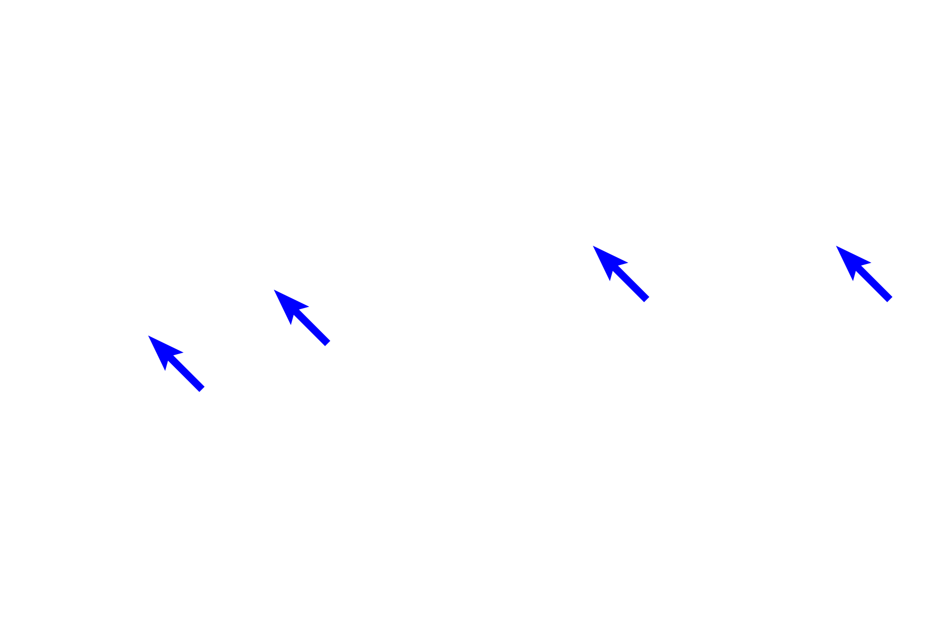 Sweat glands <p>The dermis of skin consists of two layers, a thin papillary layer immediately beneath the epidermis and a thick reticular layer.  The hypodermis lies beneath the skin but is not part of it.  Sweat glands, their ducts, blood vessels and sensory receptors (Pacinian corpuscles), are located deep in the dermis or in the adjacent hypodermis.  Thick skin  40x</p>
