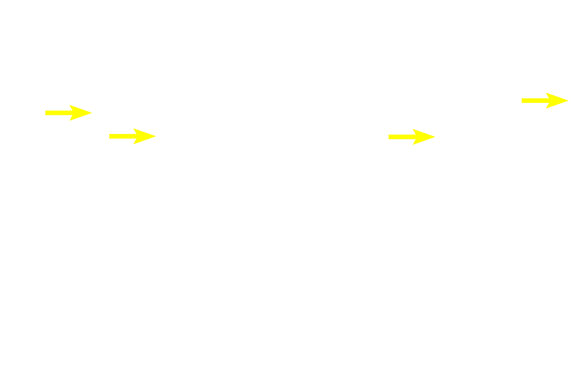 Ducts of sweat glands <p>The dermis of skin consists of two layers, a thin papillary layer immediately beneath the epidermis and a thick reticular layer.  The hypodermis lies beneath the skin but is not part of it.  Sweat glands, their ducts, blood vessels and sensory receptors (Pacinian corpuscles), are located deep in the dermis or in the adjacent hypodermis.  Thick skin  40x</p>
