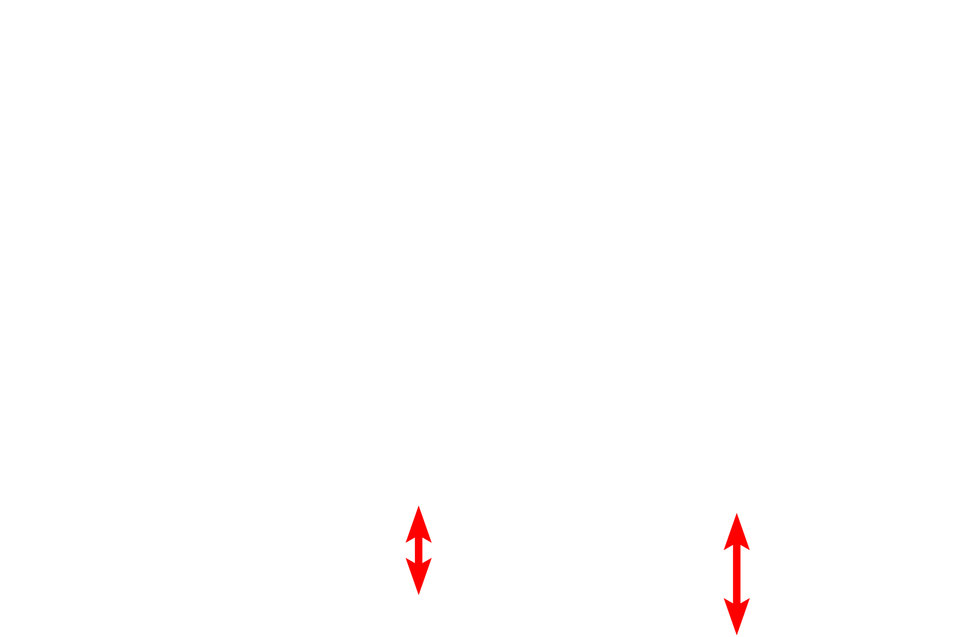 Fibroblast <p>An electron micrograph of the reticular layer of the dermis demonstrates large collagen bundles composed of numerous collagen fibrils. Also present are dark elastic fibers criss-crossing the tissue.  An active fibroblast is present in the lower part of the image.  5000x</p>
