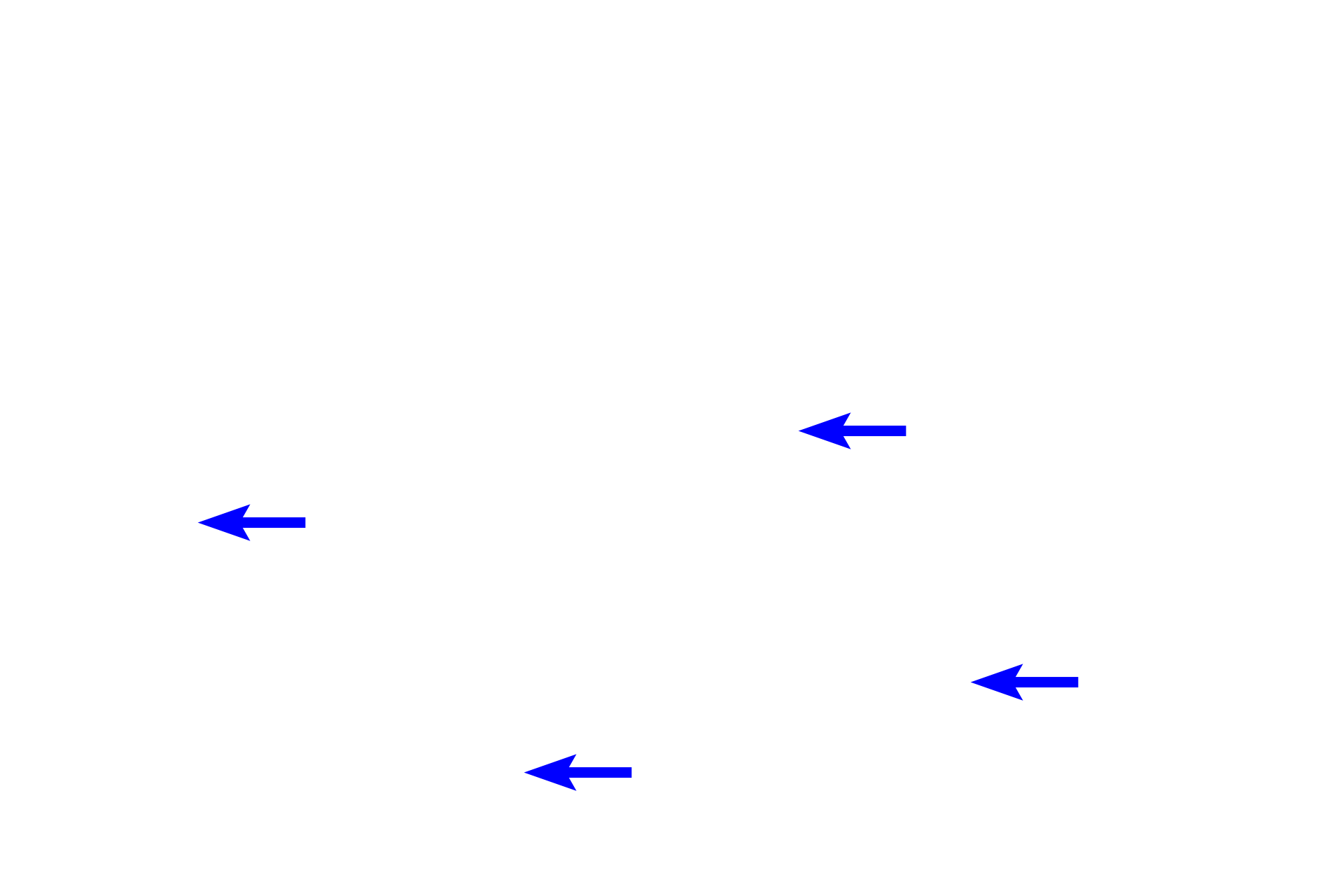  - Ducts of sweat glands <p>The dermis consists of papillary and reticular layers.  The papillary layer, located immediately beneath the epidermis, is composed of loose connective tissue.  The papillary layer contains dermal papillae that alternate with epidermal ridges or pegs (rete ridges or pegs).  The reticular layer is composed of dense, irregular CT and contains large blood vessels, nerves and sometimes sweat glands.  100x</p>
