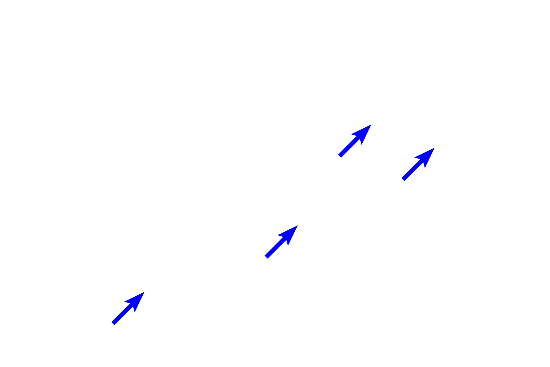  - Epidermal ridges (pegs) <p>The papillary layer of the dermis, composed of loose connective tissue, forms an undulating interface with the overlying epidermis.  At this junction, dermal papillae alternate with epidermal ridges or pegs (rete ridges or pegs) projecting downward from the epidermis.  The thicker reticular layer of dermis is composed of dense irregular connective tissue.  200x</p>
